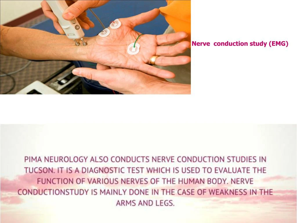 nerve conduction test painful