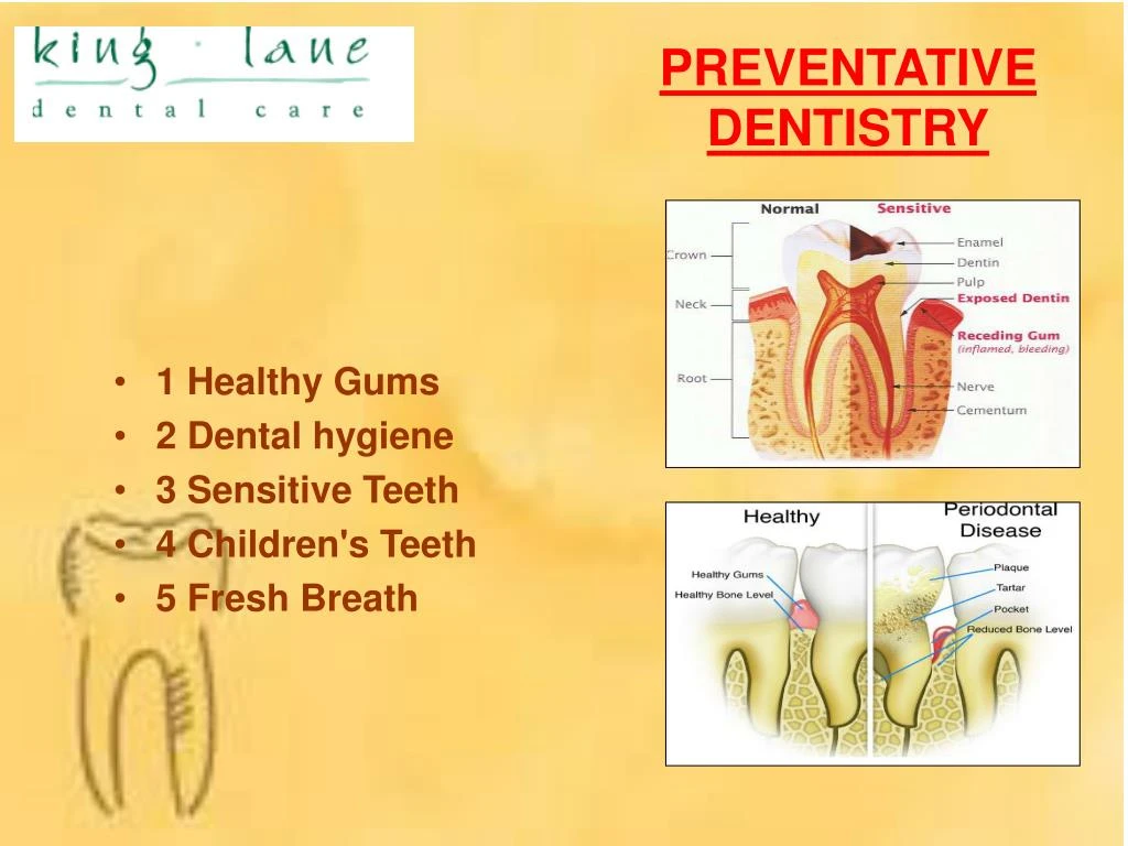 PPT - Emergency Dental Care PowerPoint Presentation - ID:7354080