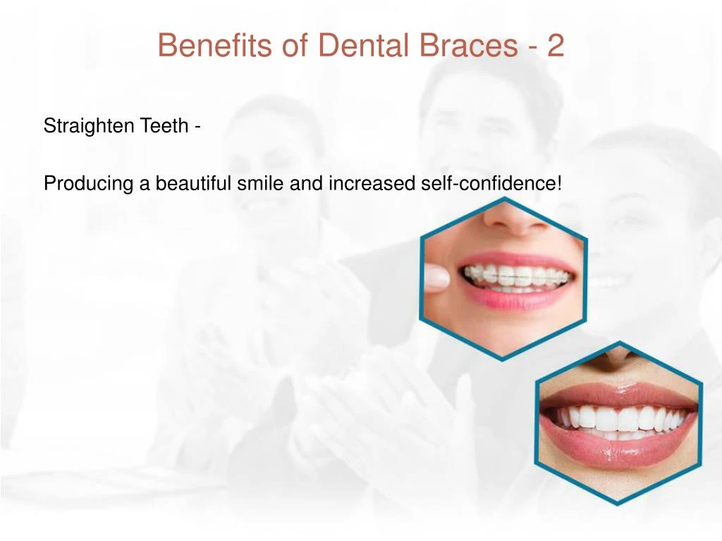 PPT - Advantages Of Dental Braces PowerPoint Presentation - ID:7354833