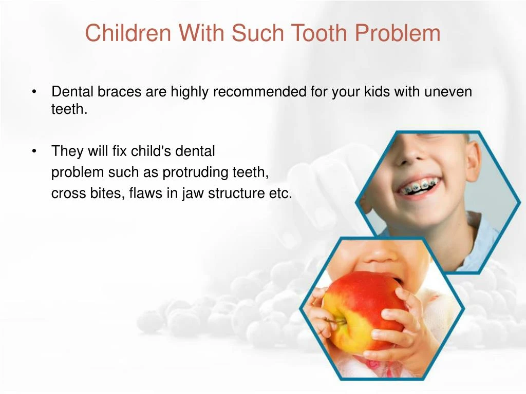 PPT - Advantages Of Dental Braces PowerPoint Presentation - ID:7354833