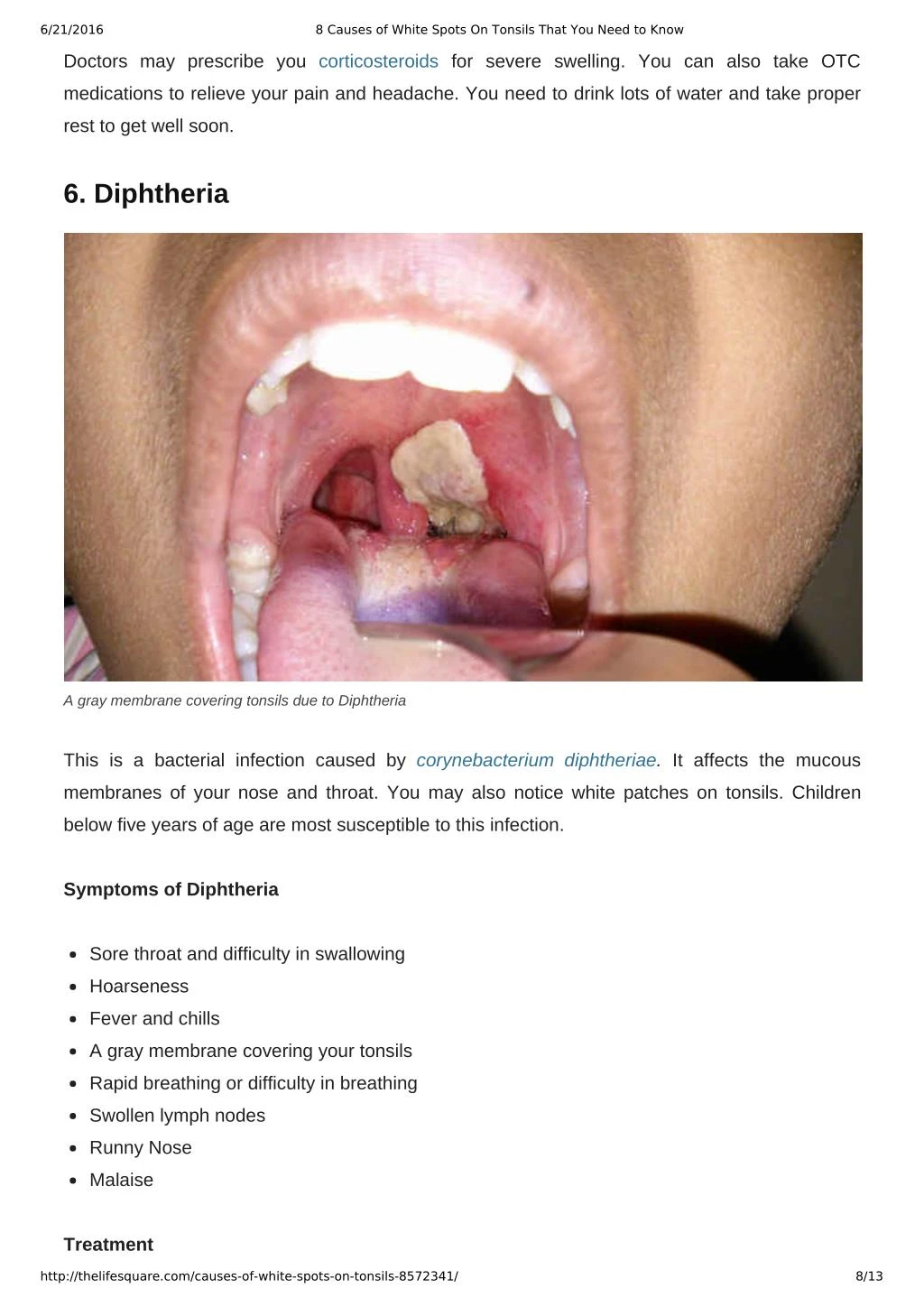 Ppt Causes Of White Spots On Tonsils You May Not Know Powerpoint