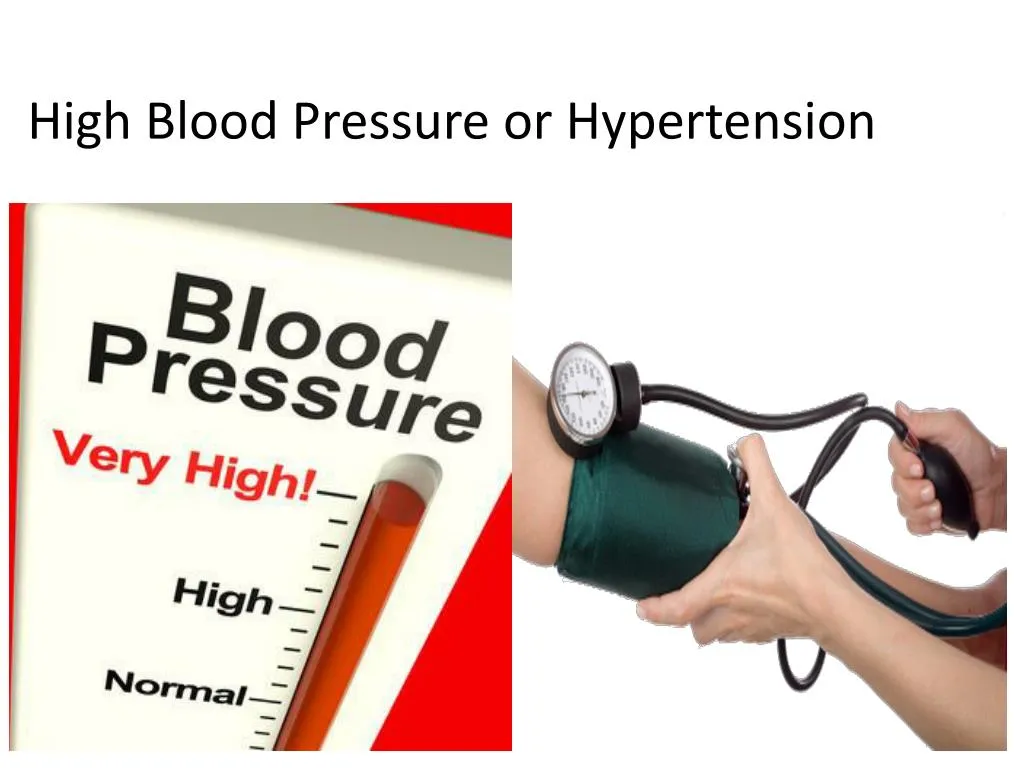 Ppt Causes Of High Blood Pressure Powerpoint Presentation Id7395632