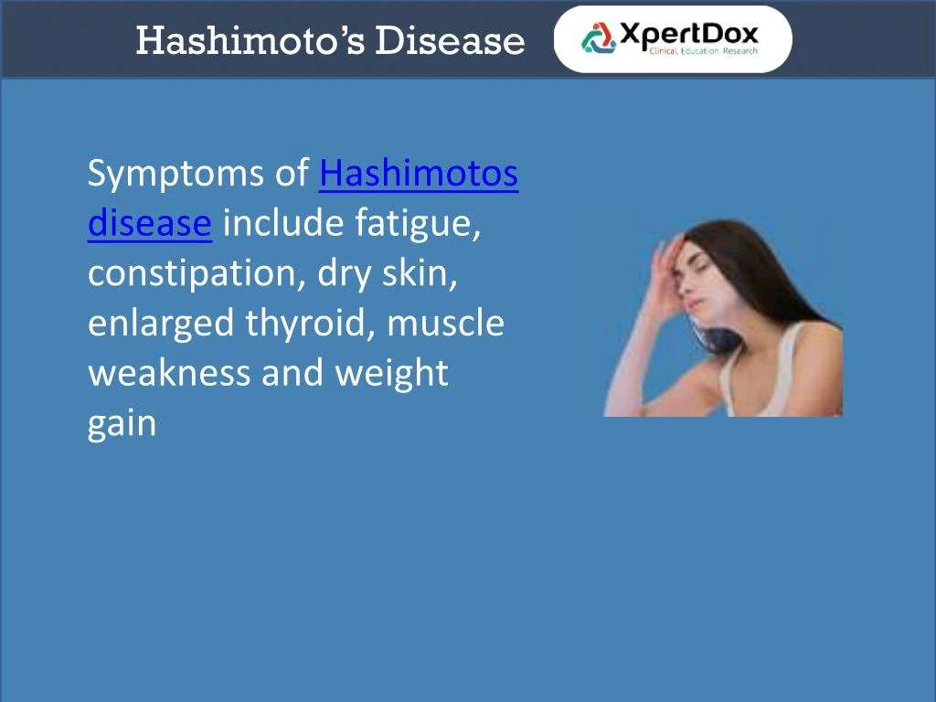 Ppt Hashimotos Disease Powerpoint Presentation Id 7396295