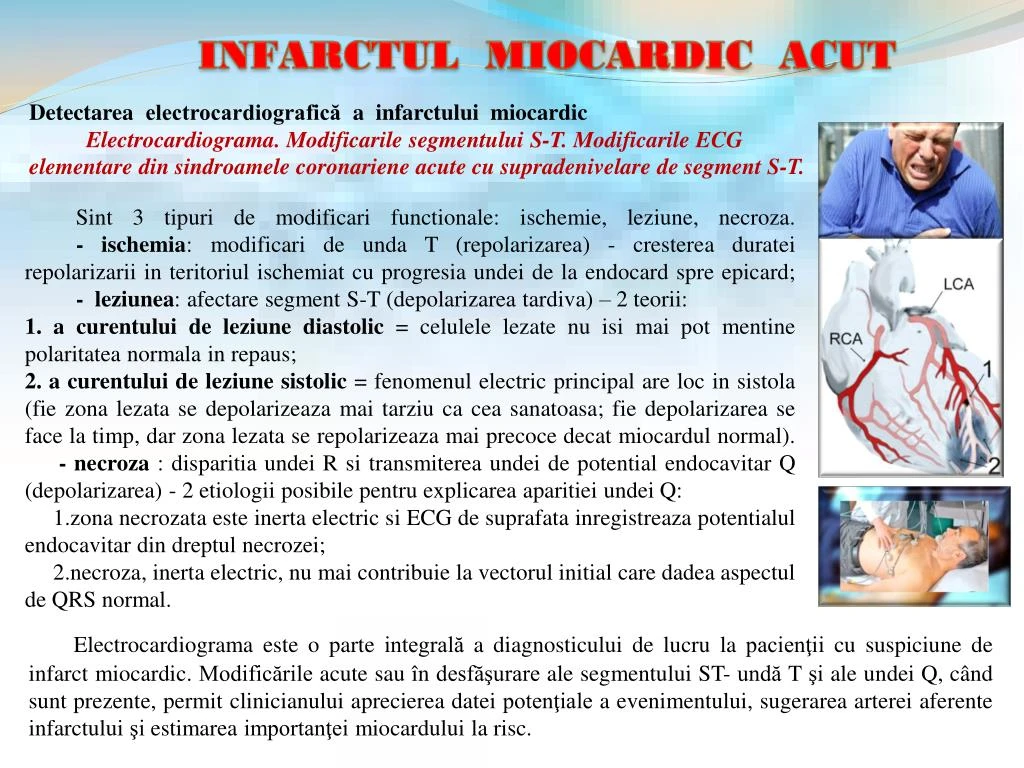 Ppt Infarctul Miocardic Acut Powerpoint Presentation Id 7411495