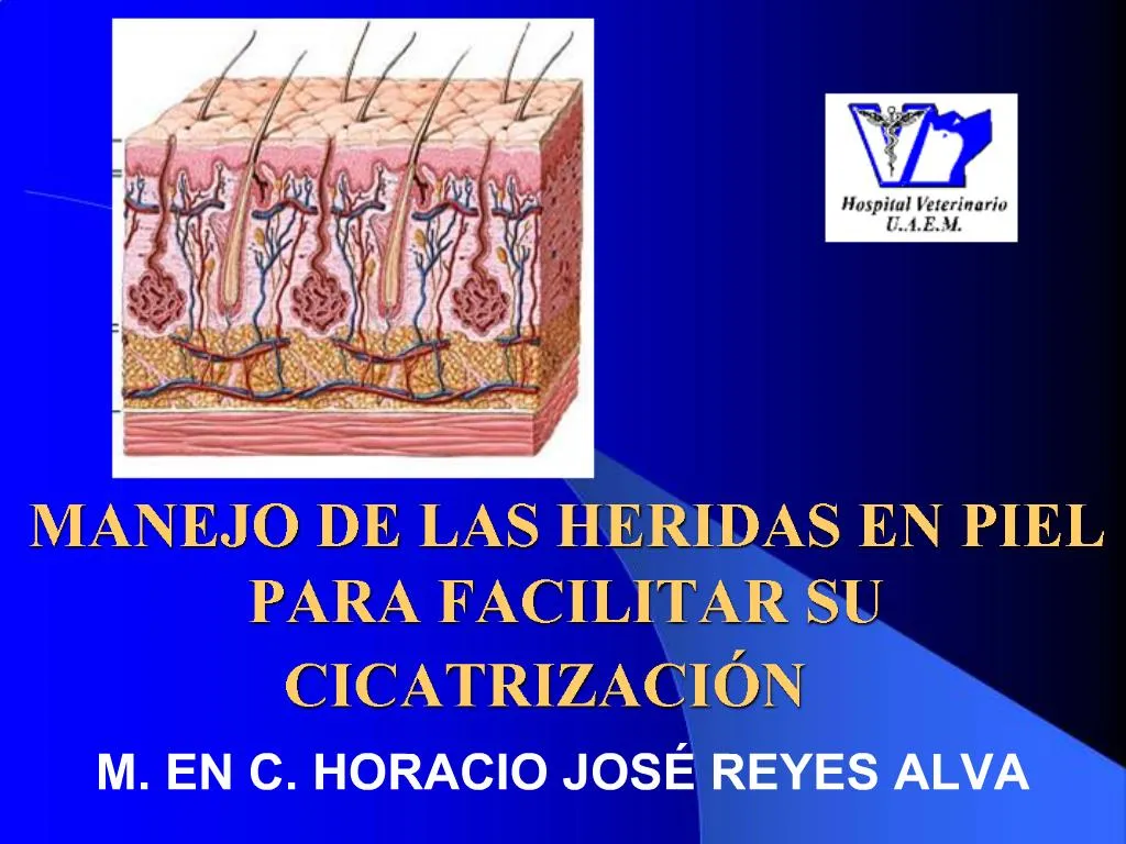 PPT MANEJO DE LAS HERIDAS EN PIEL PARA FACILITAR SU CICATRIZACI N