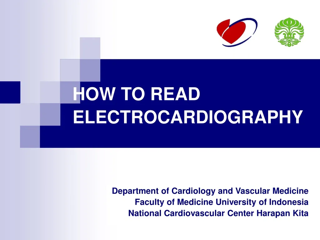 how to read electrocardiography n.