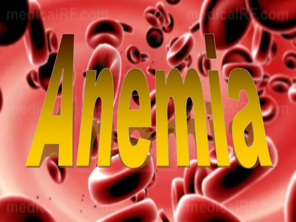 Ppt - Anemia Powerpoint Presentation, Free Download - Id:1089994