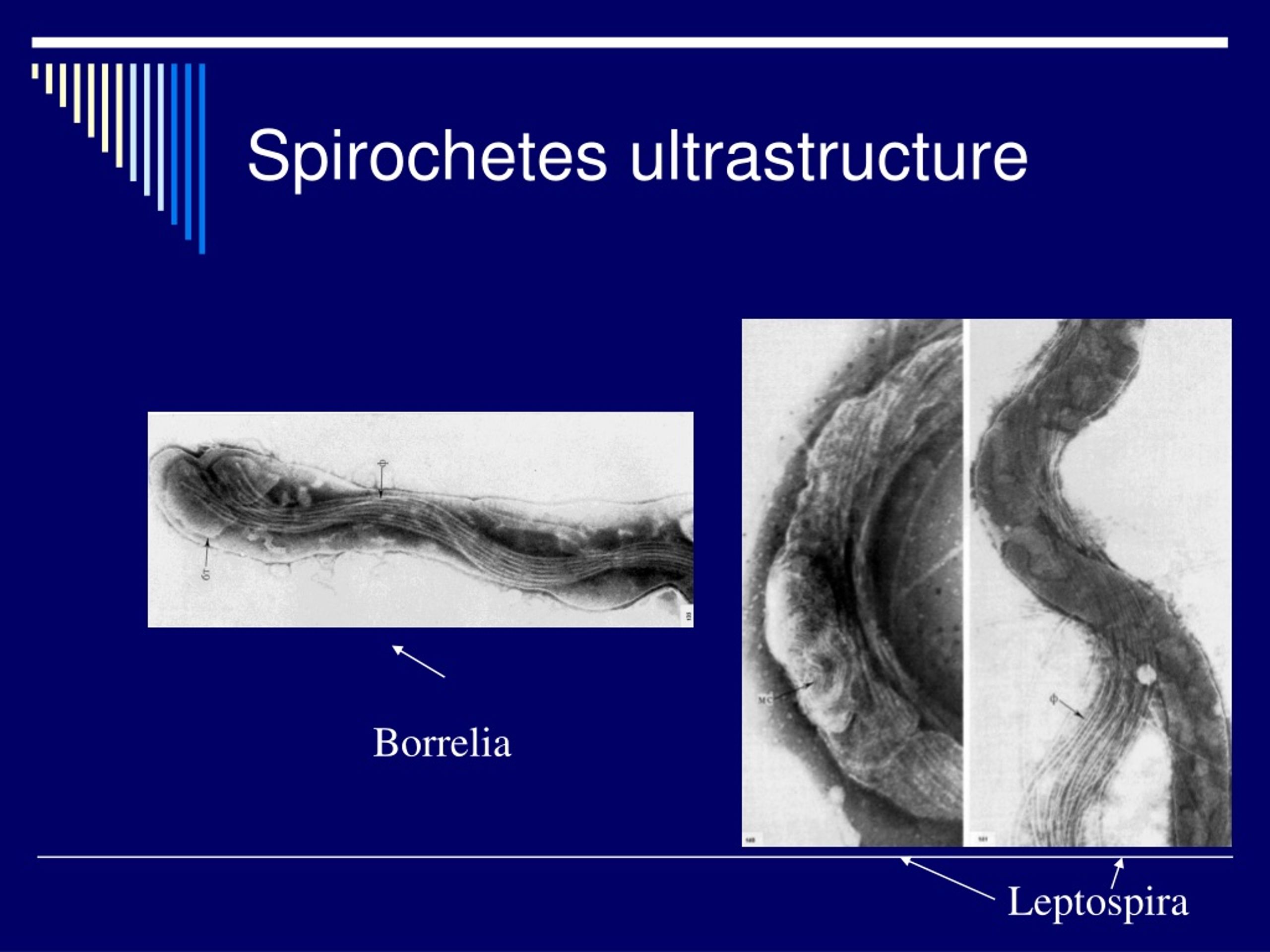 Ppt Pathogenic Spirochetes Powerpoint Presentation Free Download Id1090445 7692