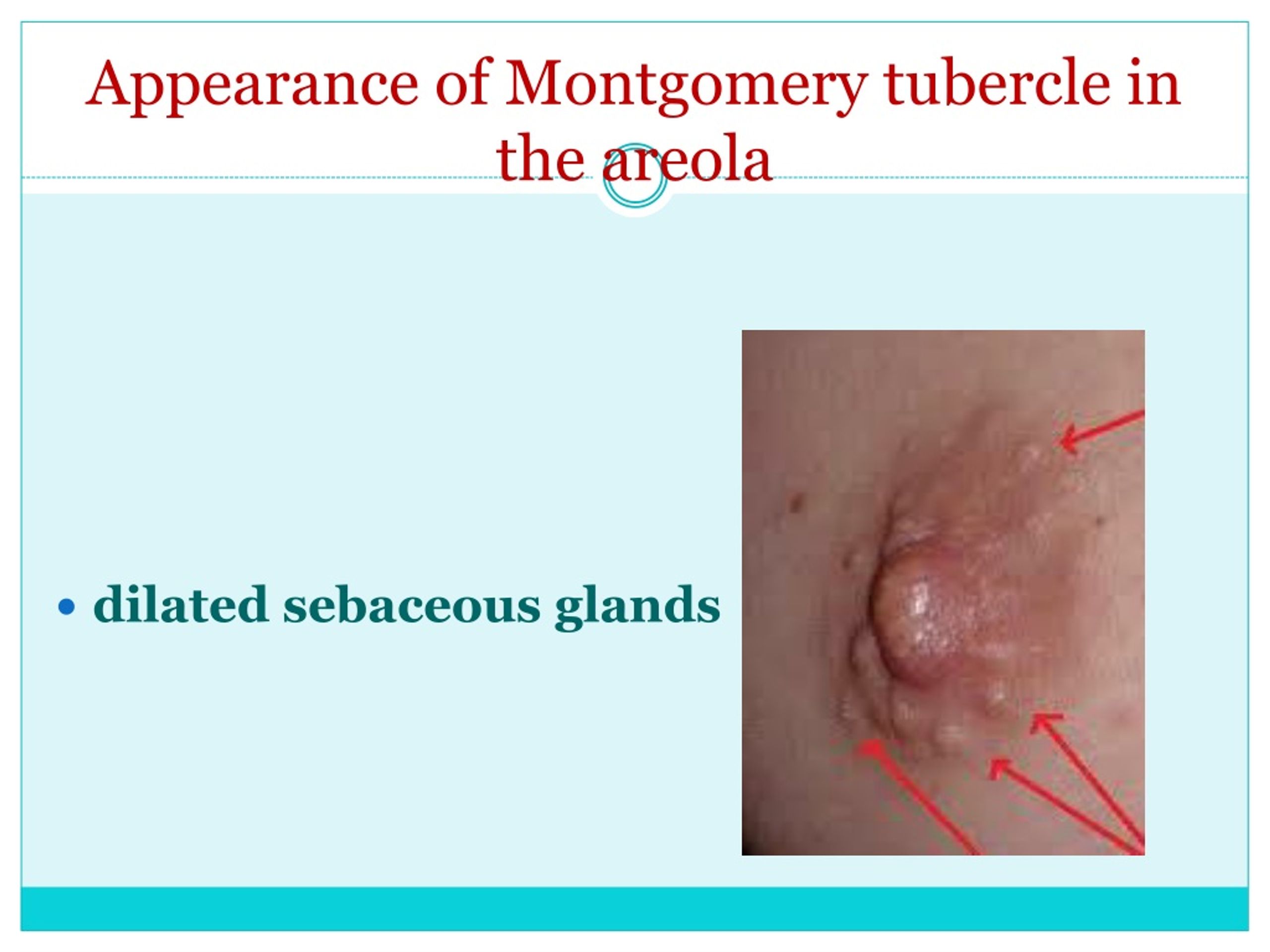 Ppt Diagnosis Of Pregnancy Antenal Care For Undergraduate Powerpoint Presentation Id 1153625