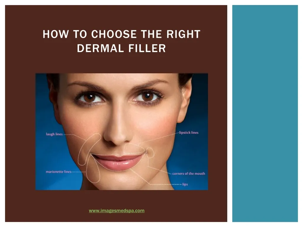 how to choose the r ight dermal f iller n.