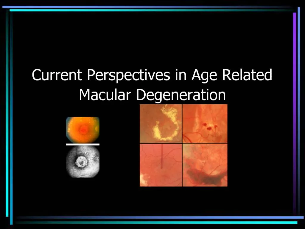 PPT - Current Perspectives in Age Related Macular Degeneration ...