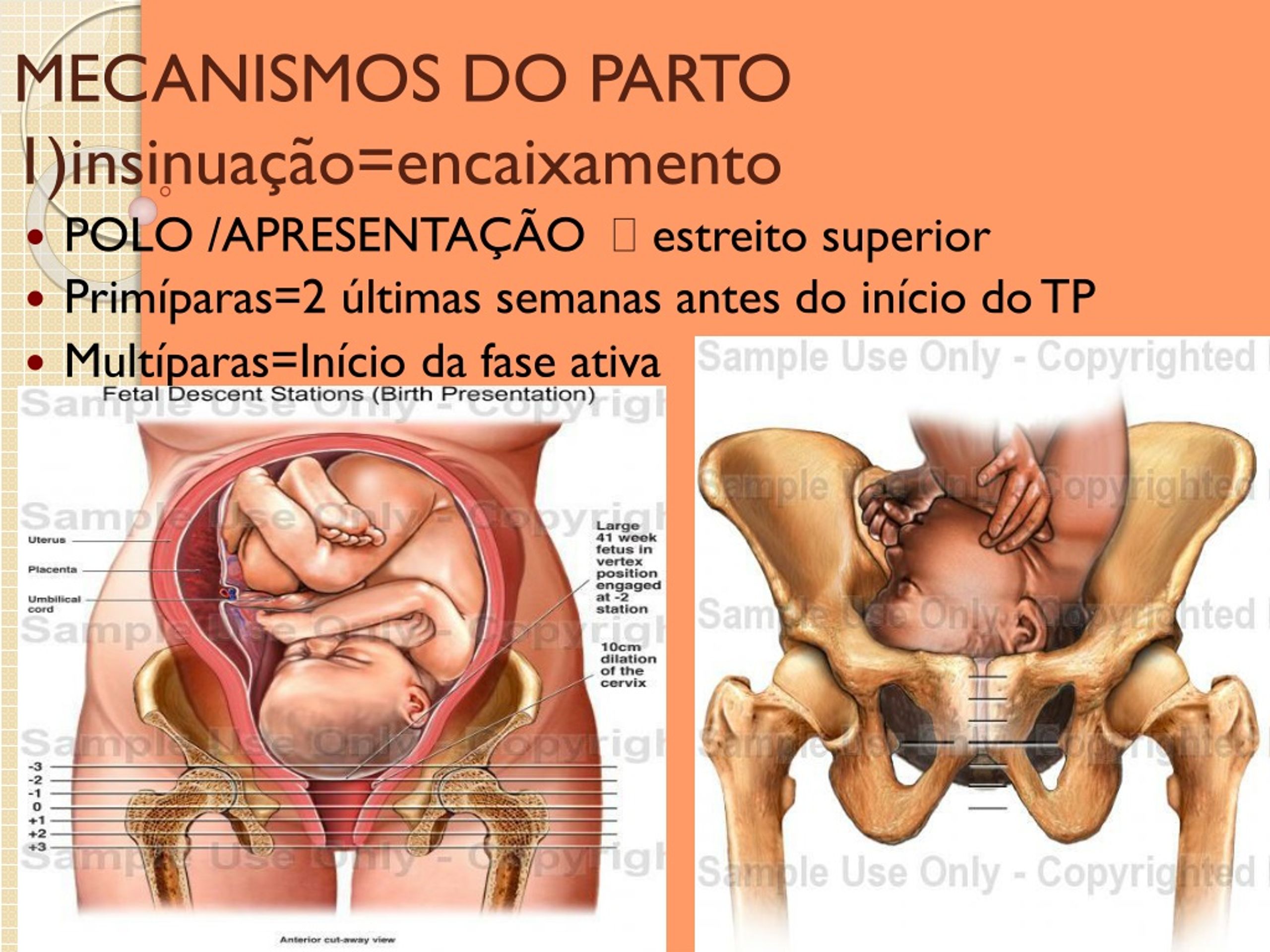 Ppt Trabalho De Parto 01 Powerpoint Presentation Free Download Id1238419 6360