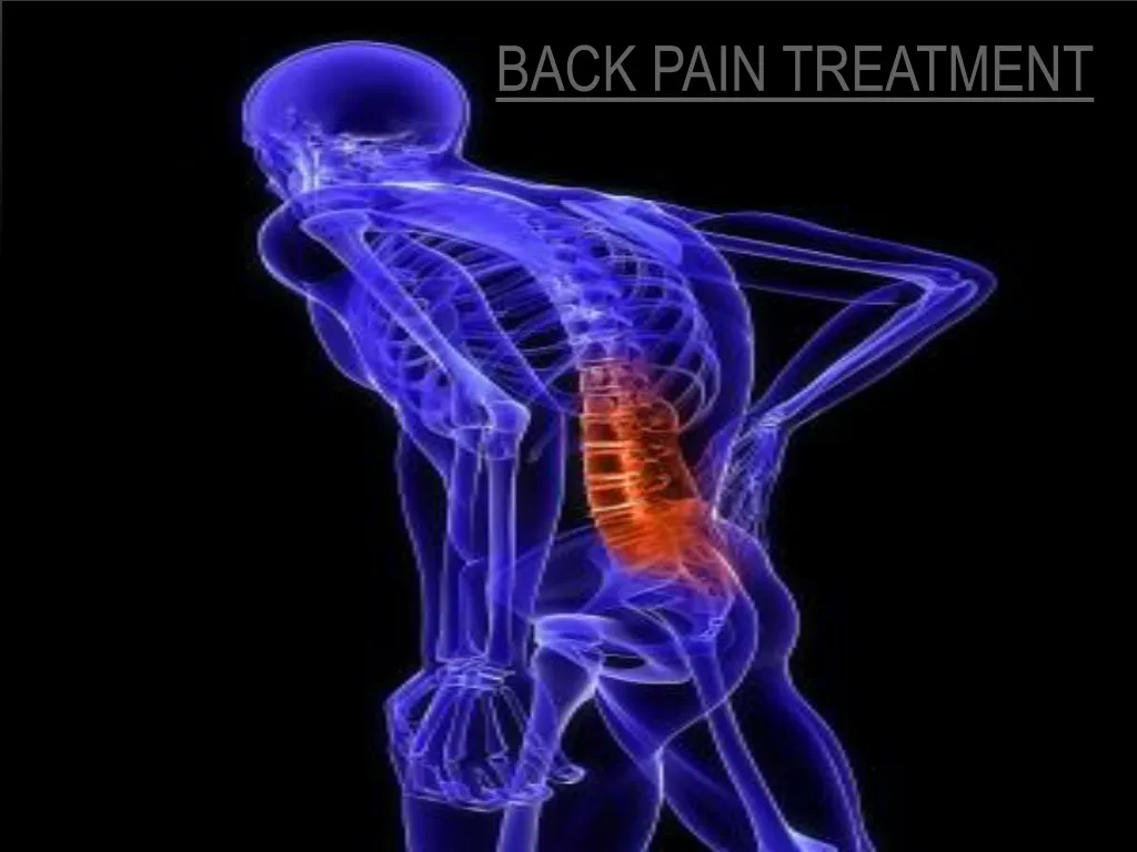 back pain treatment n.