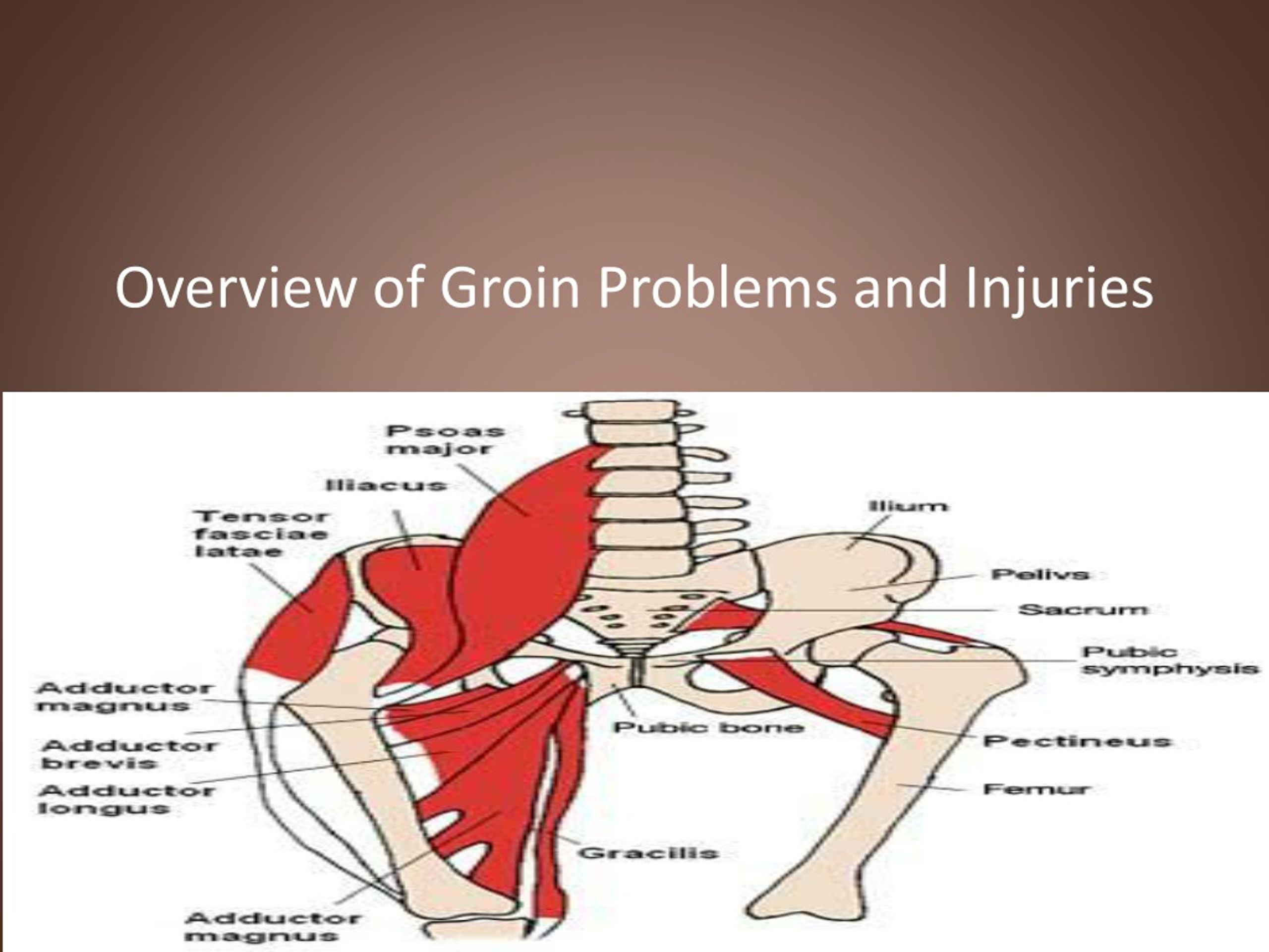 Groin Pain Groin Injuries Symptoms Causes Treatment - vrogue.co
