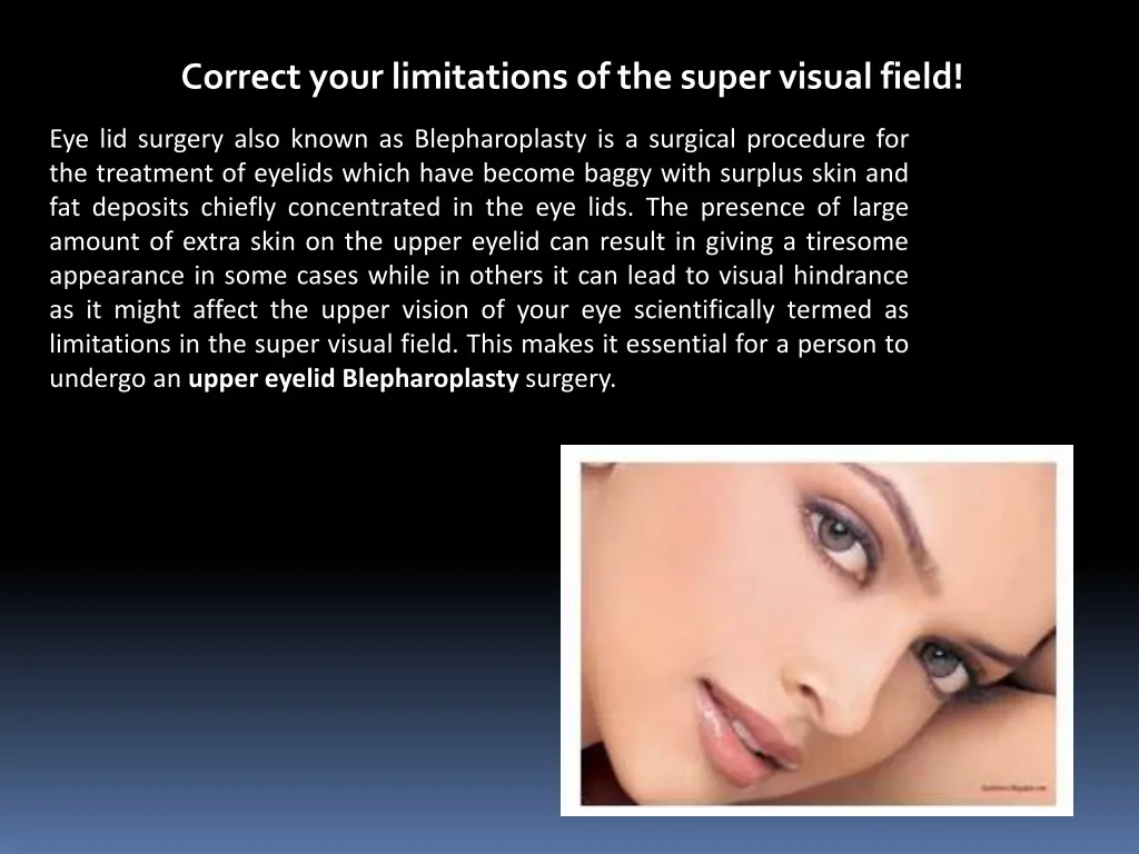 correct your limitations of the super visual field n.