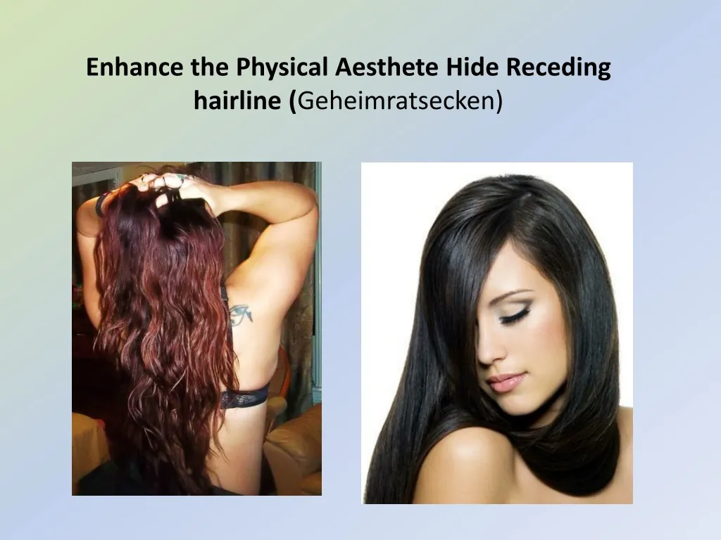 enhance the physical aesthete hide receding hairline geheimratsecken n.