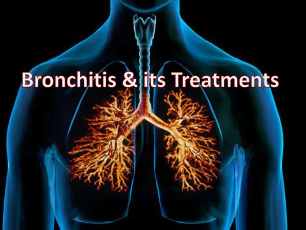 bronchitis presentation