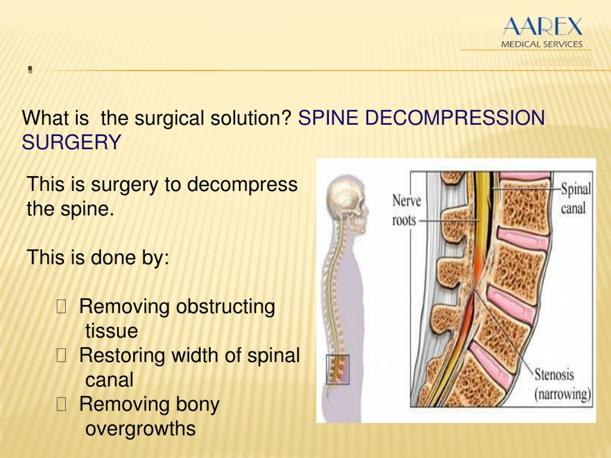 Ppt Spine Decompression Surgery Powerpoint Presentation Free Download Id1355130 