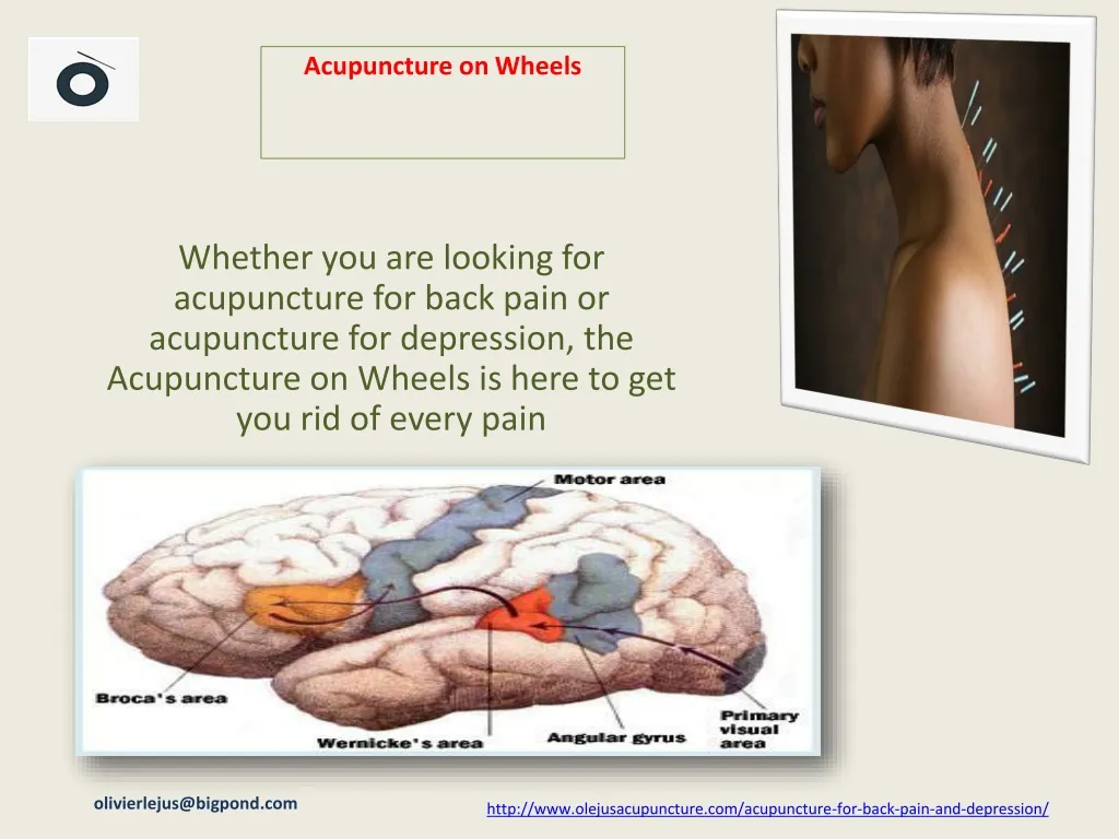 acupuncture on wheels n.