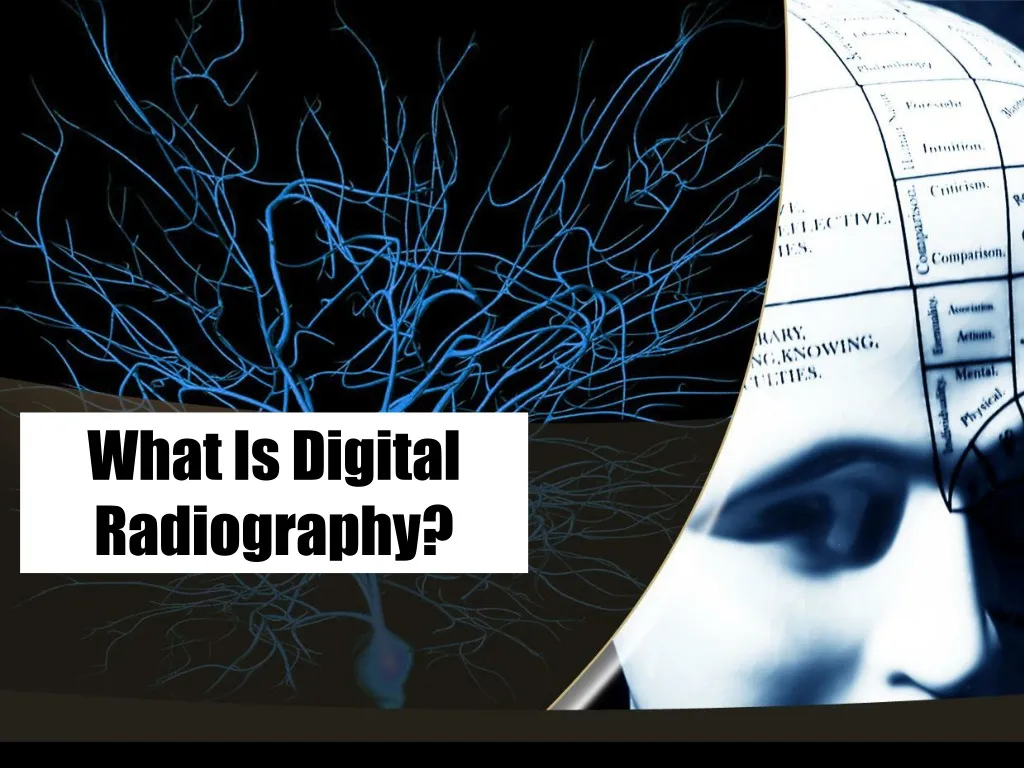 PPT - What Is Digital Radiography? PowerPoint Presentation, Free ...