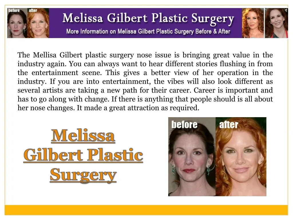 the mellisa gilbert plastic surgery nose issue n.