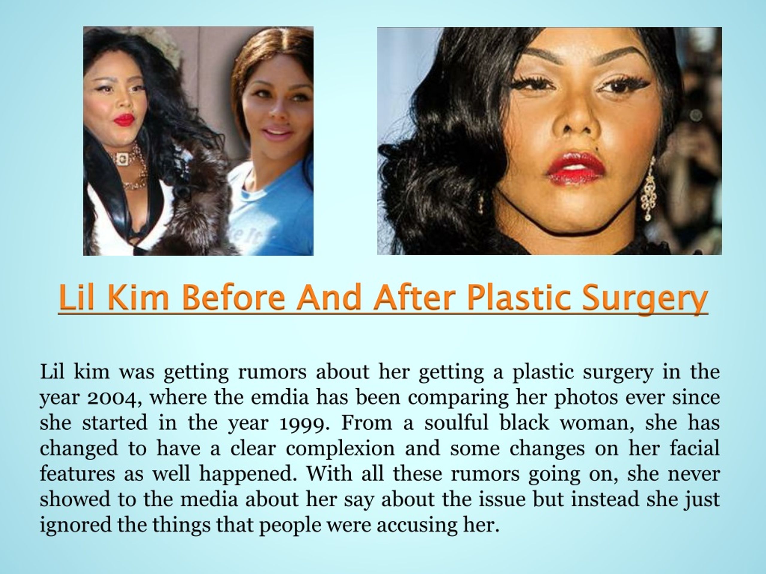 Lil kim plastic surgery before and after