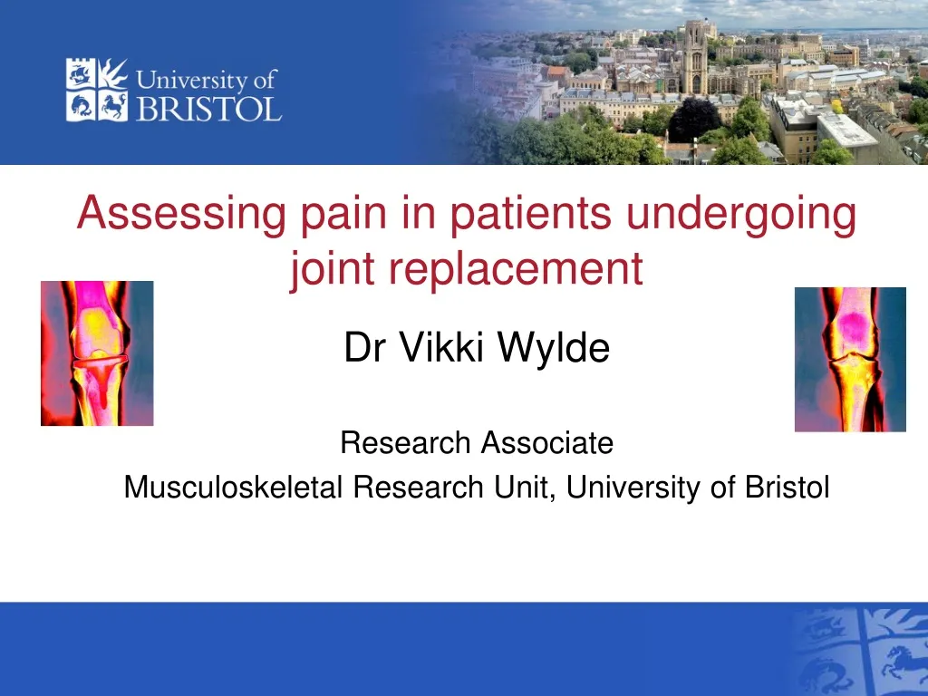 assessing pain in patients undergoing joint replacement n.