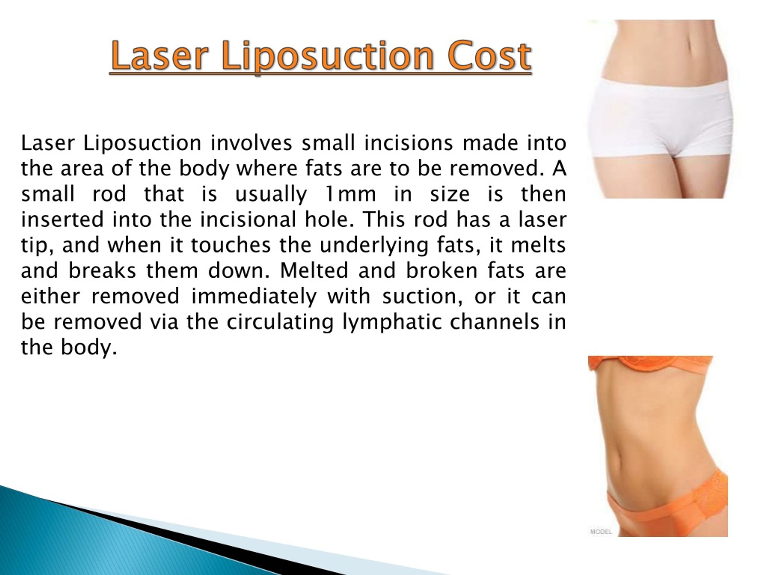PPT How Much Is Liposuction PowerPoint Presentation, free download