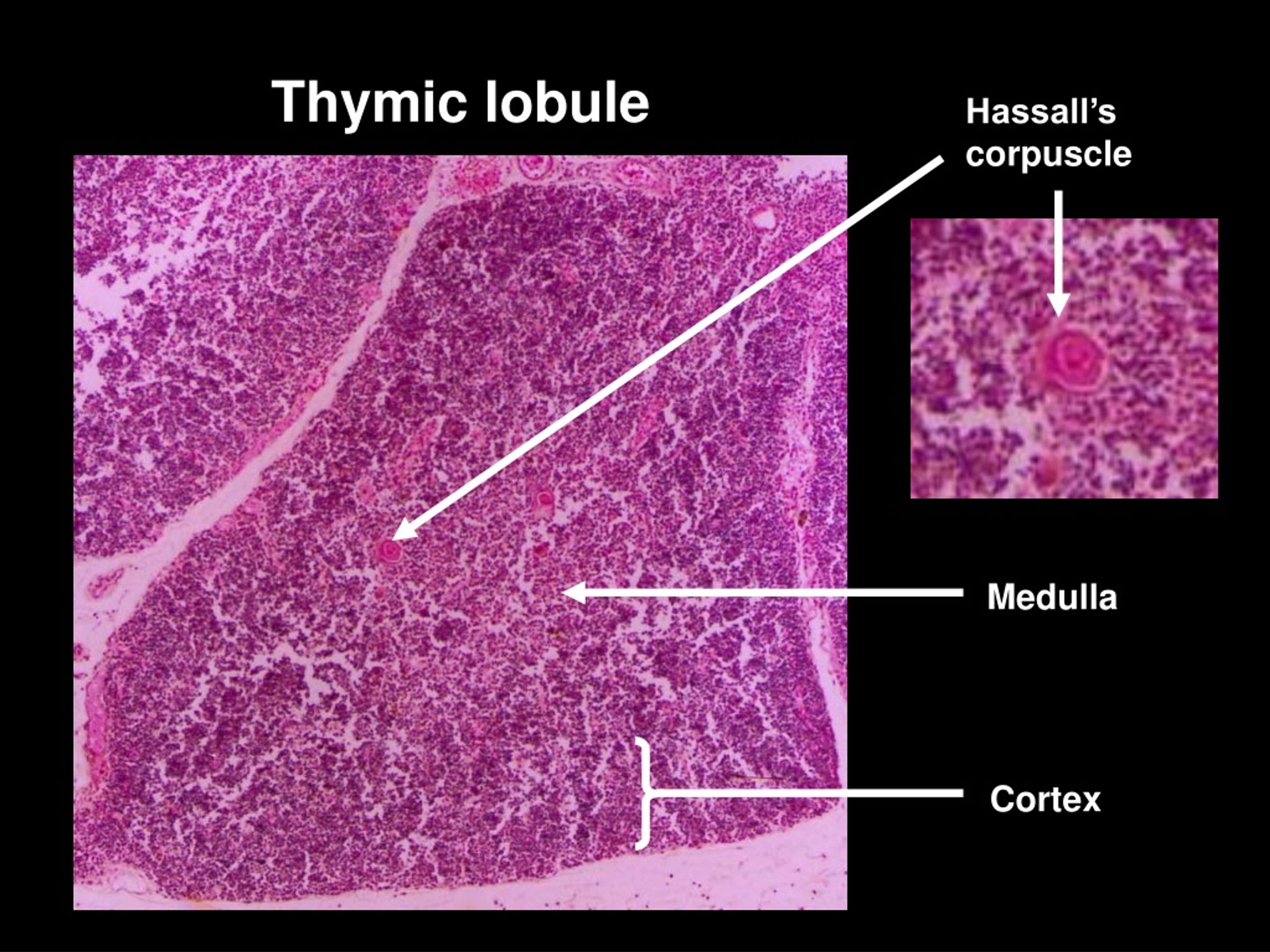 PPT - Thymus PowerPoint Presentation, free download - ID:1483566