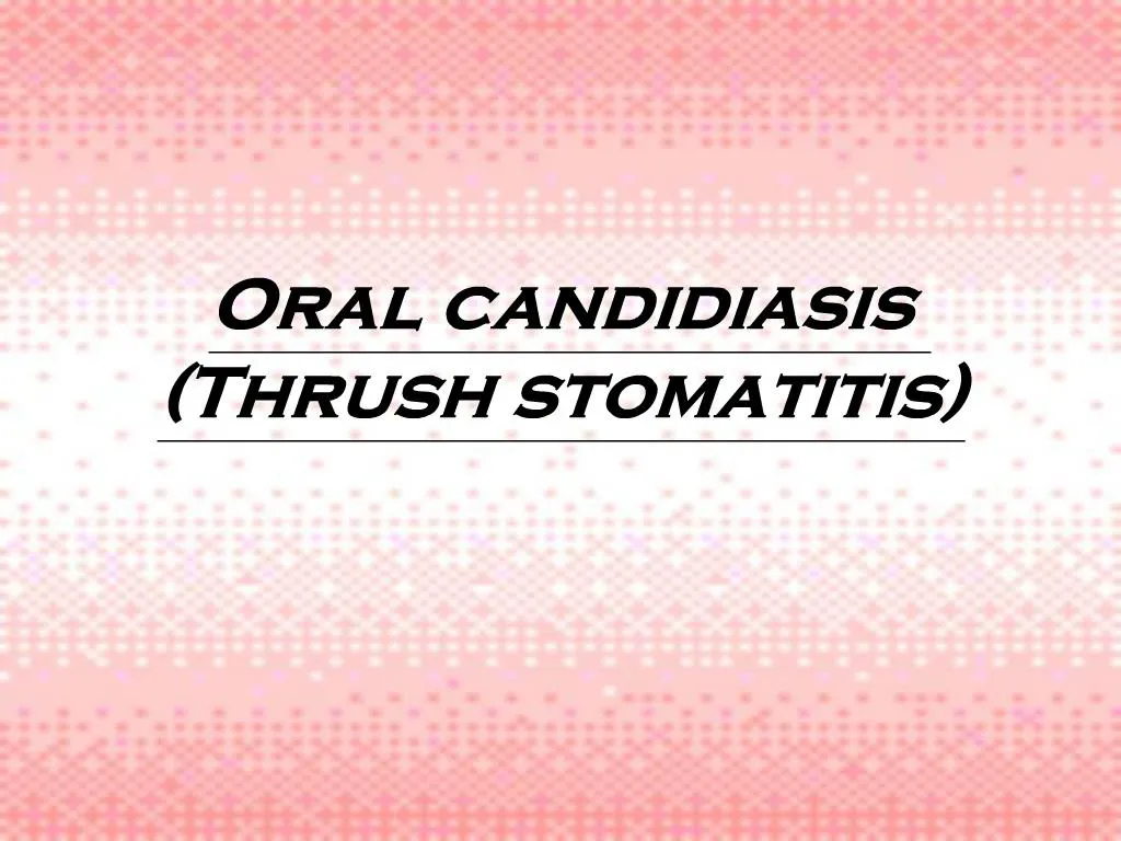 PPT - Oral candidiasis Thrush stomatitis PowerPoint Presentation, free ...