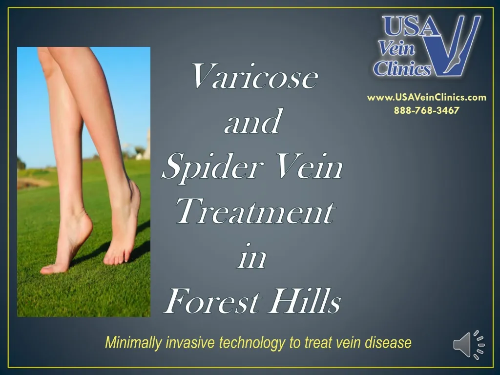 varicose and spider vein treatment in forest hills n.