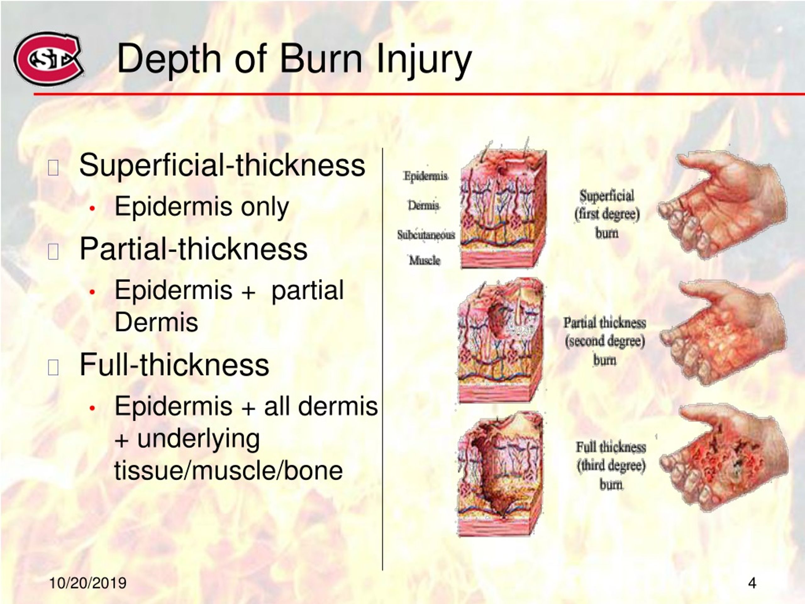 Ppt Nursing Care And Interventions In The Client With Burn Injury