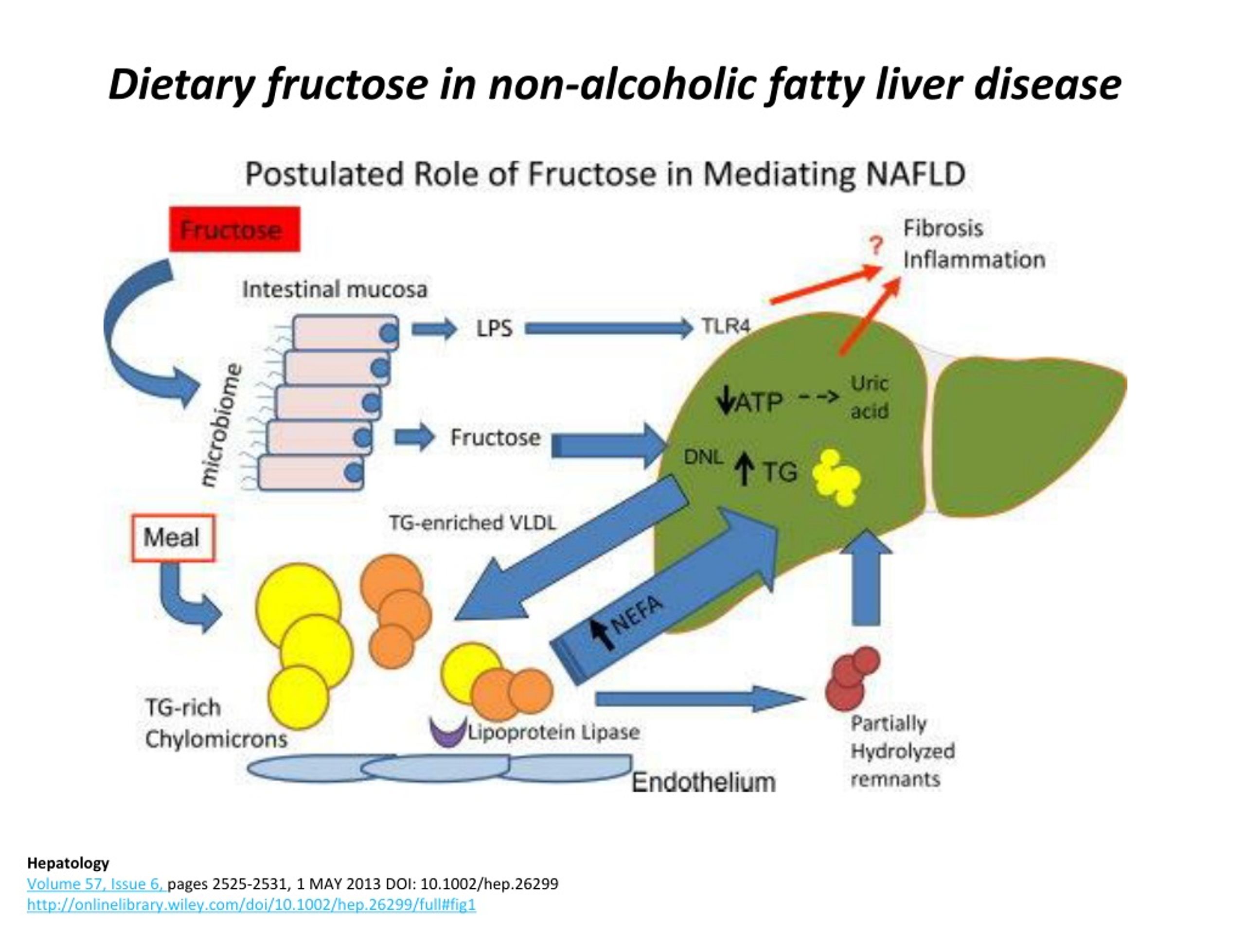 Фруктоза и печень. Lipoprotein lipase. Фруктоза ожирение печени. Pathogenesis of nonalcoholic fatty Liver disease (NAFLD).