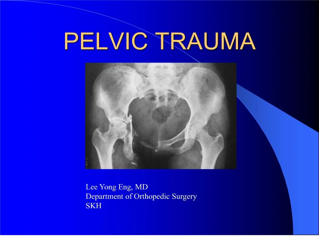 PPT PELVIC TRAUMA PowerPoint Presentation, free download ID181848
