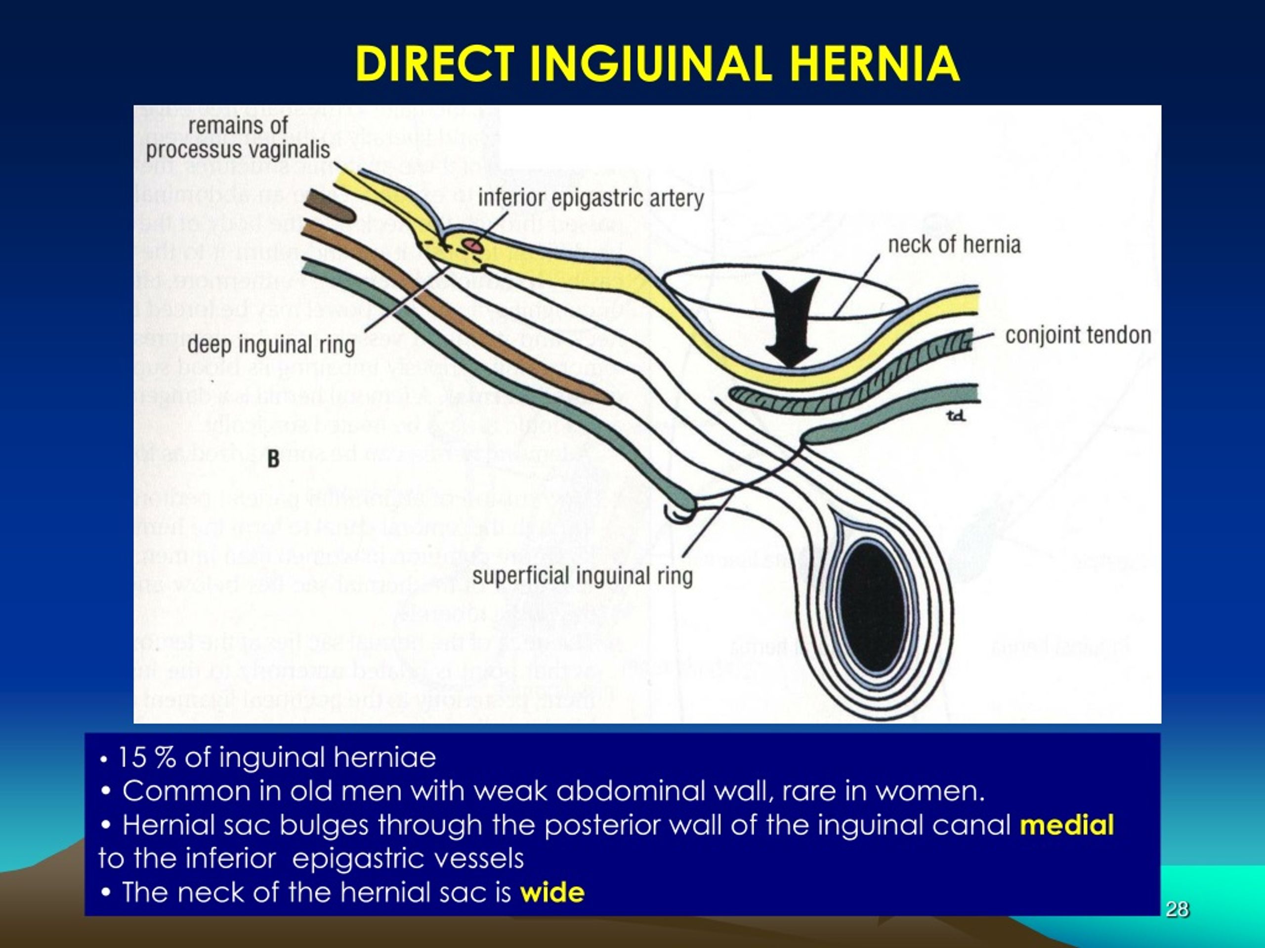 PPT - A ntero l ateral A bdominal Wall A nd PowerPoint Presentation ...