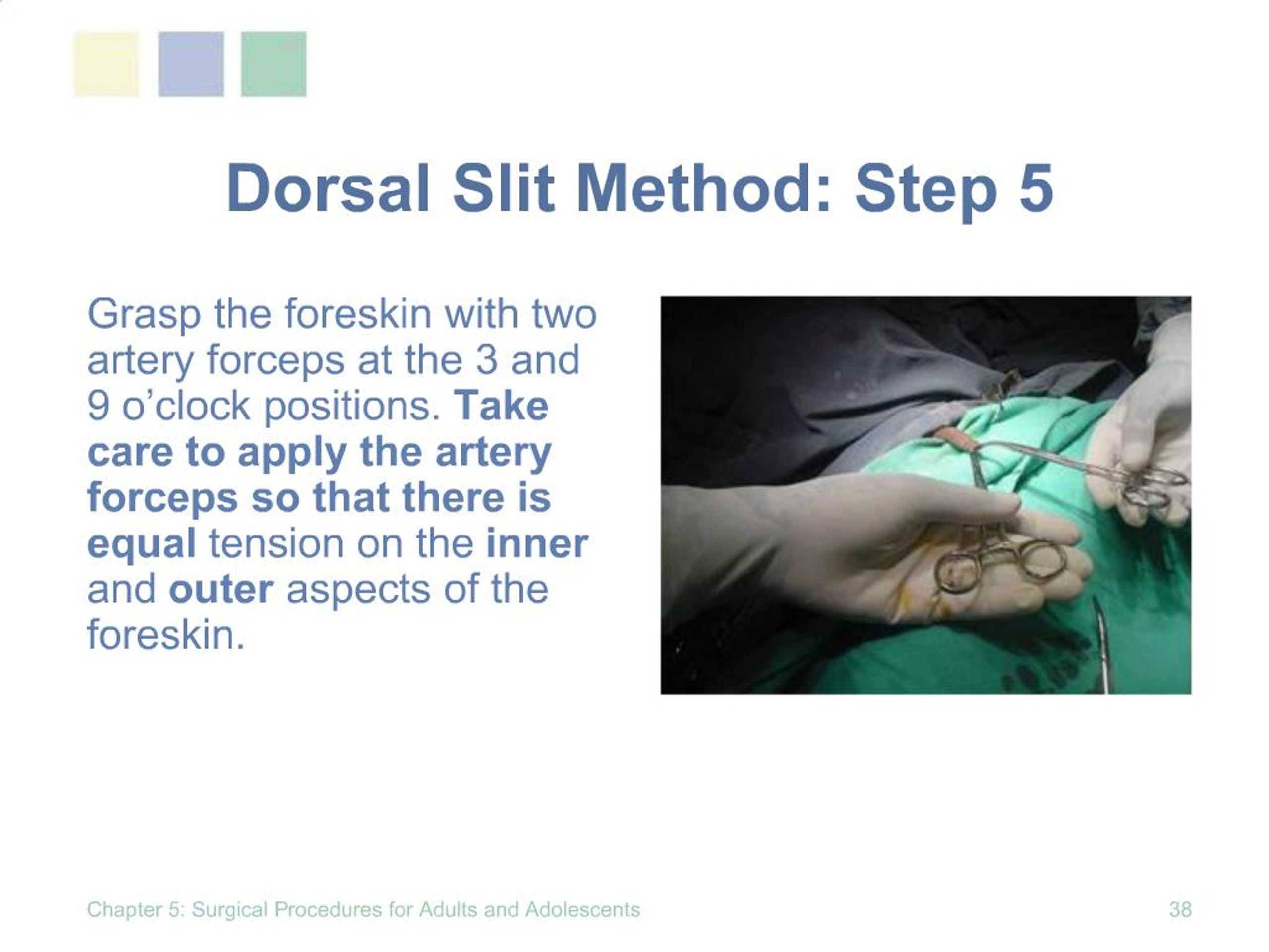 Procedure dorsal slit Adult Circumcision
