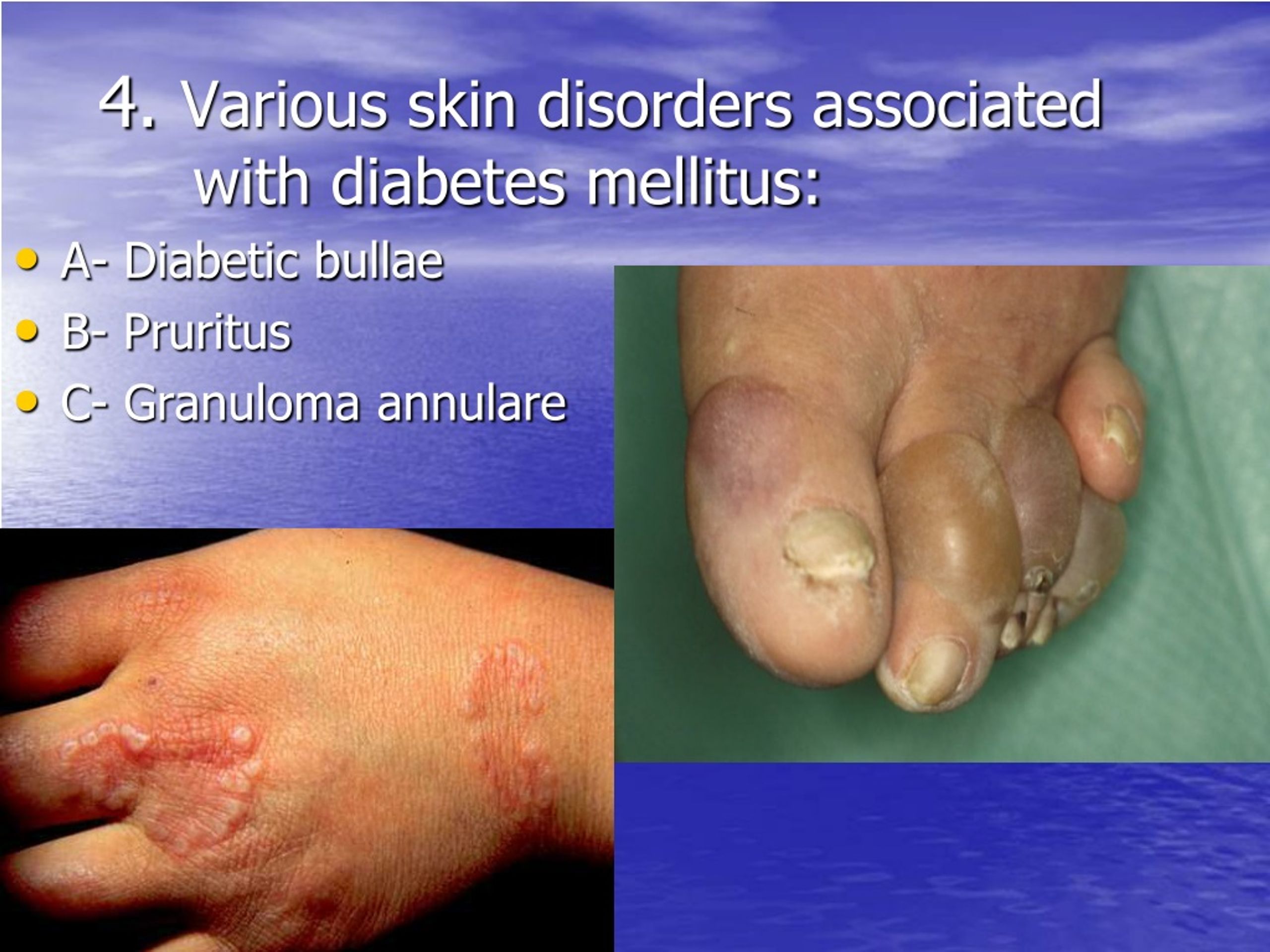 PPT - Dermatological Manifestations of Systemic Diseases PowerPoint
