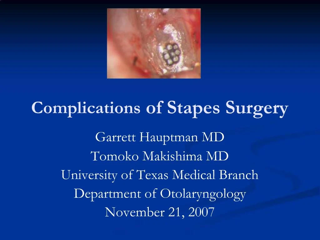 PPT Complications of Stapes Surgery PowerPoint Presentation, free
