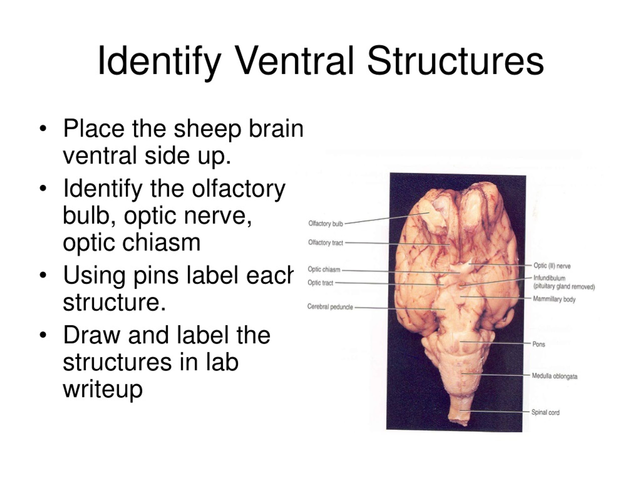 mammillary body sheep brain
