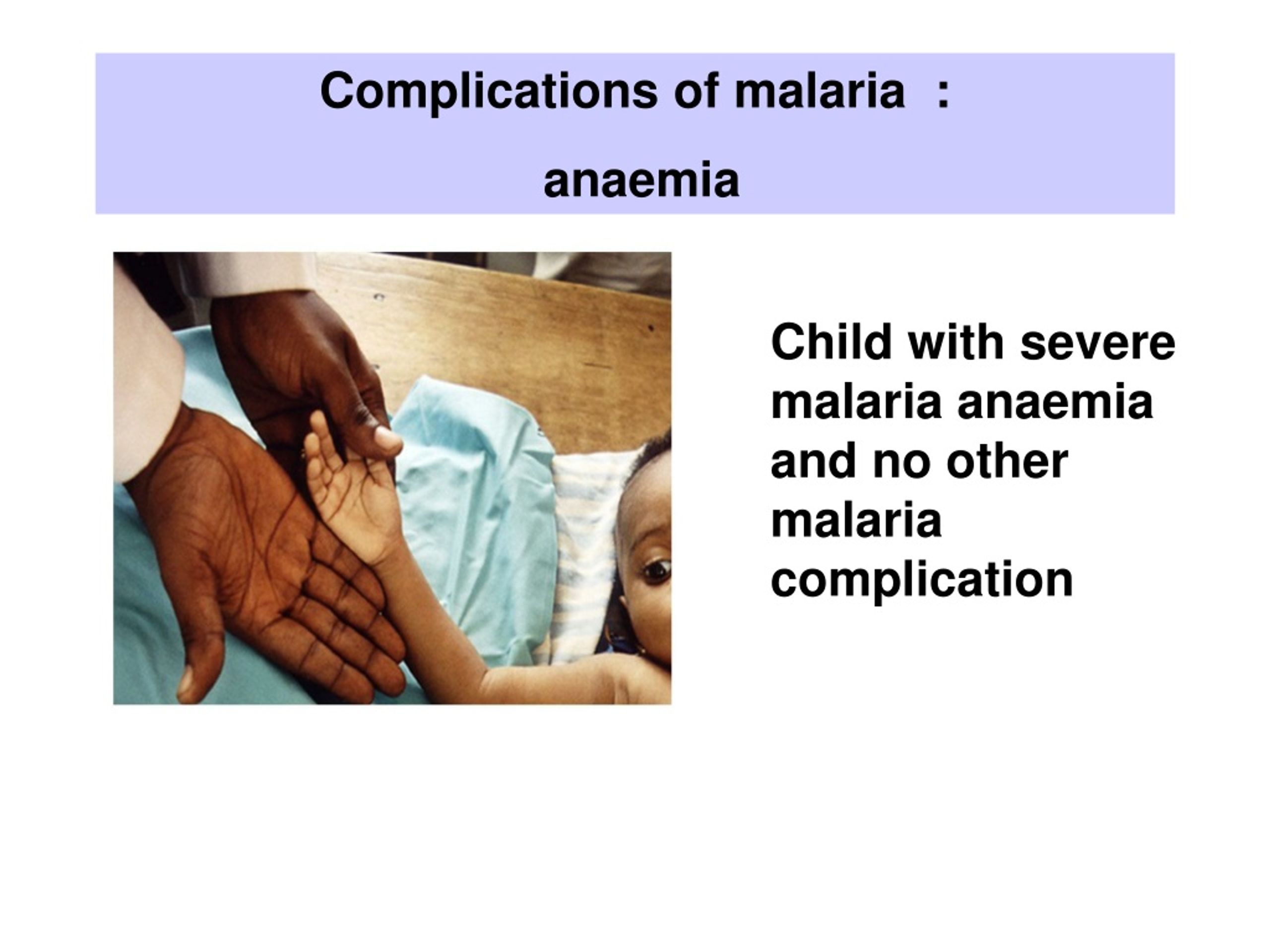 malaria powerpoint presentation free download