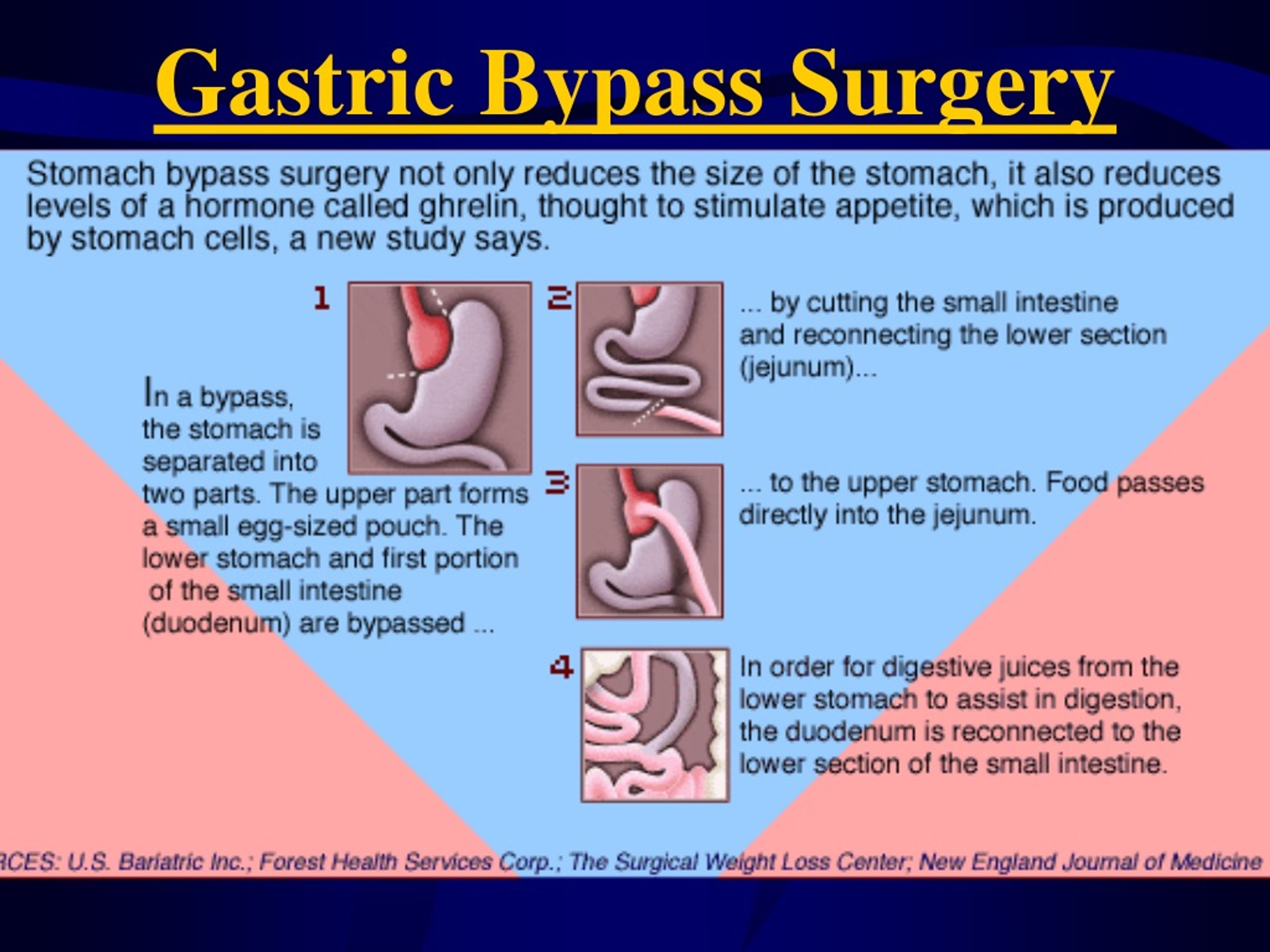 Ppt Digestive System Powerpoint Presentation Free Download Id285202 9291