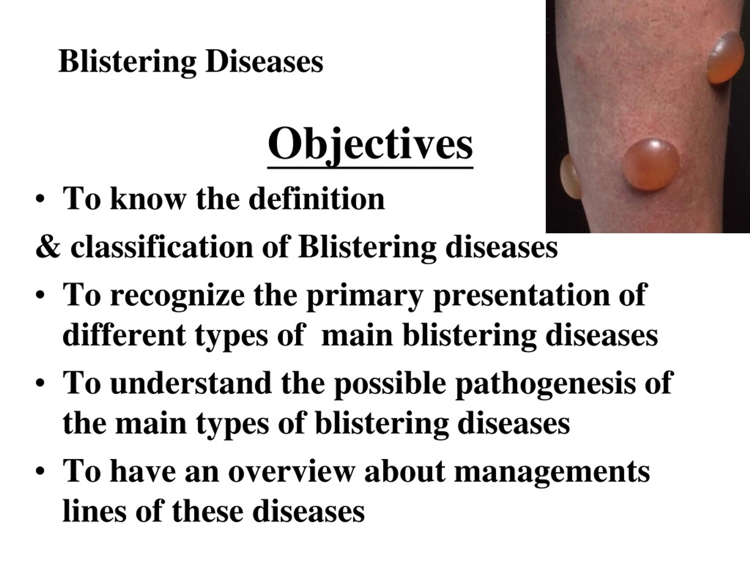 Ppt Blistering Diseases Powerpoint Presentation Free Download Id