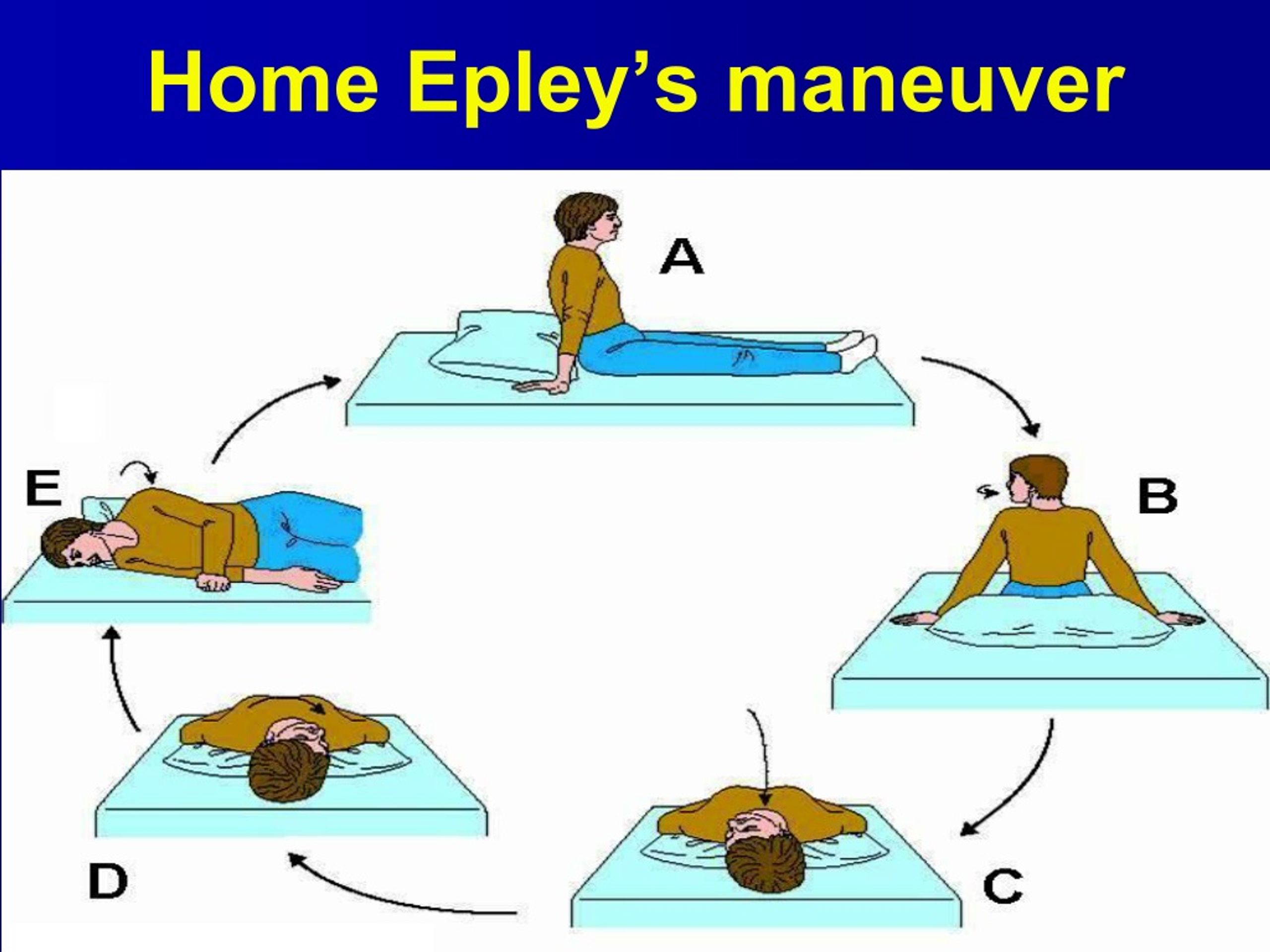 epley maneuver for vertigo left ear