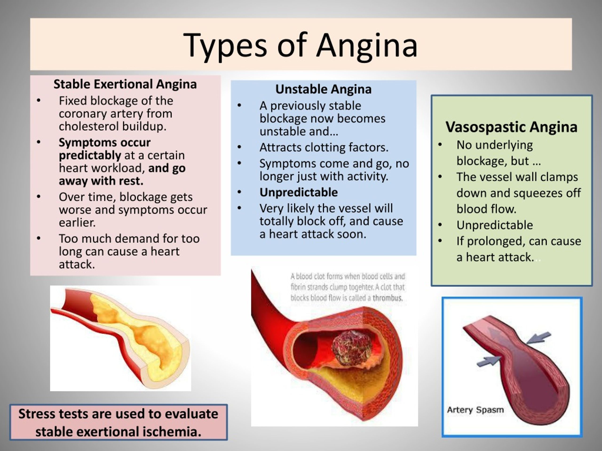 Angina System Disorder Template