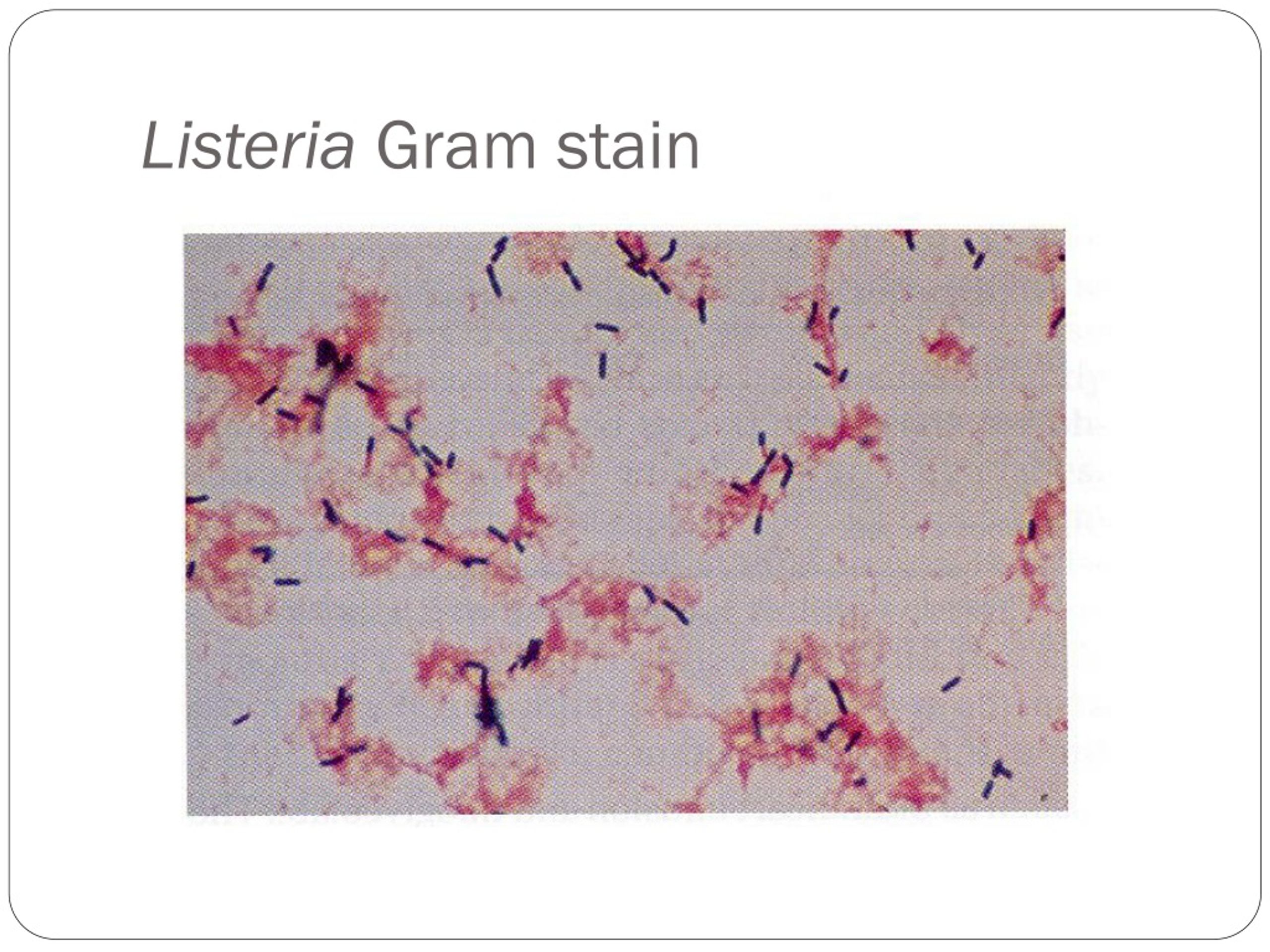 PPT - Listeria, Erysipelothrix PowerPoint Presentation, free download ...