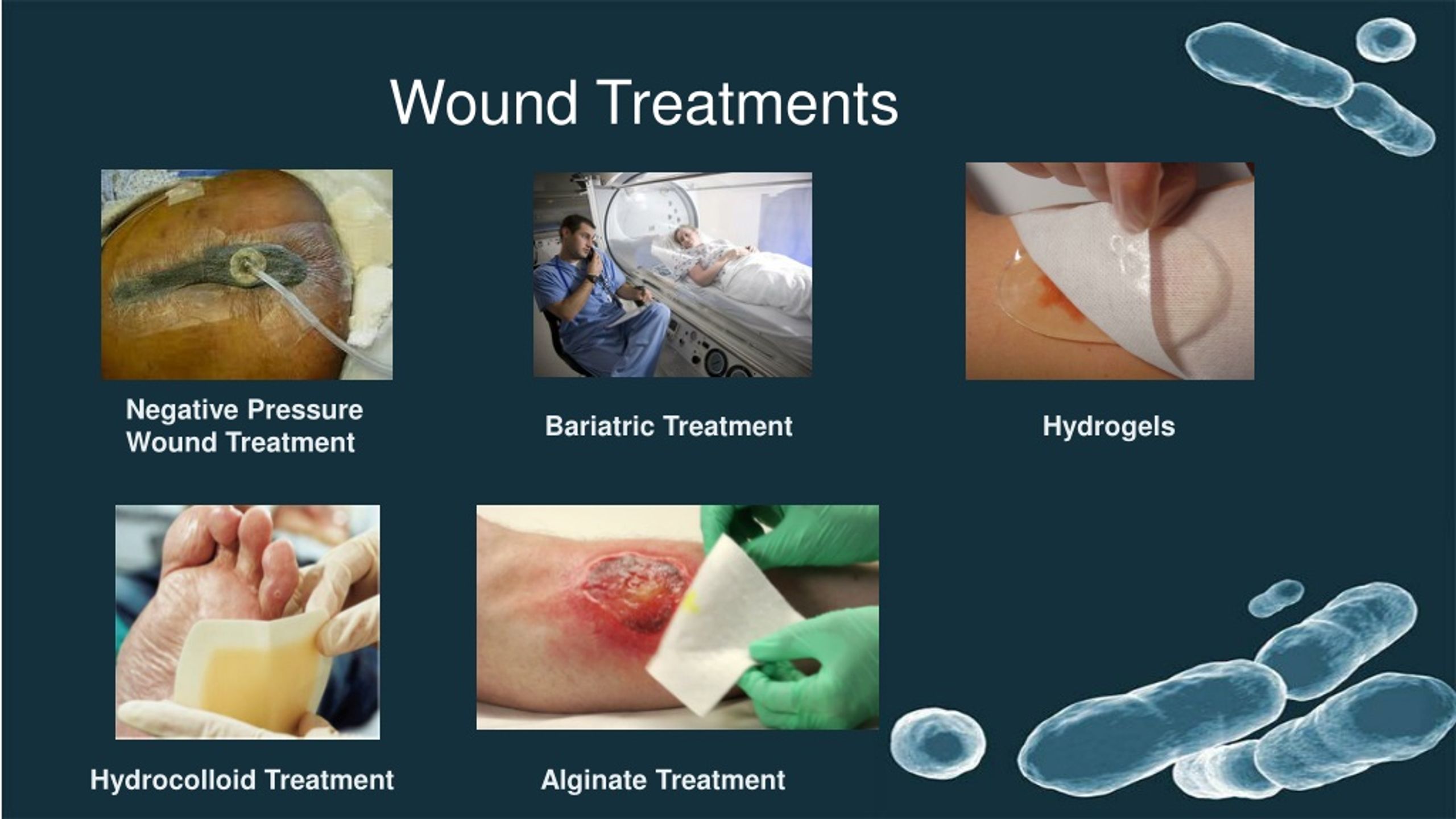 Ppt Wound Care Basics Powerpoint Presentation Free Download Id317874