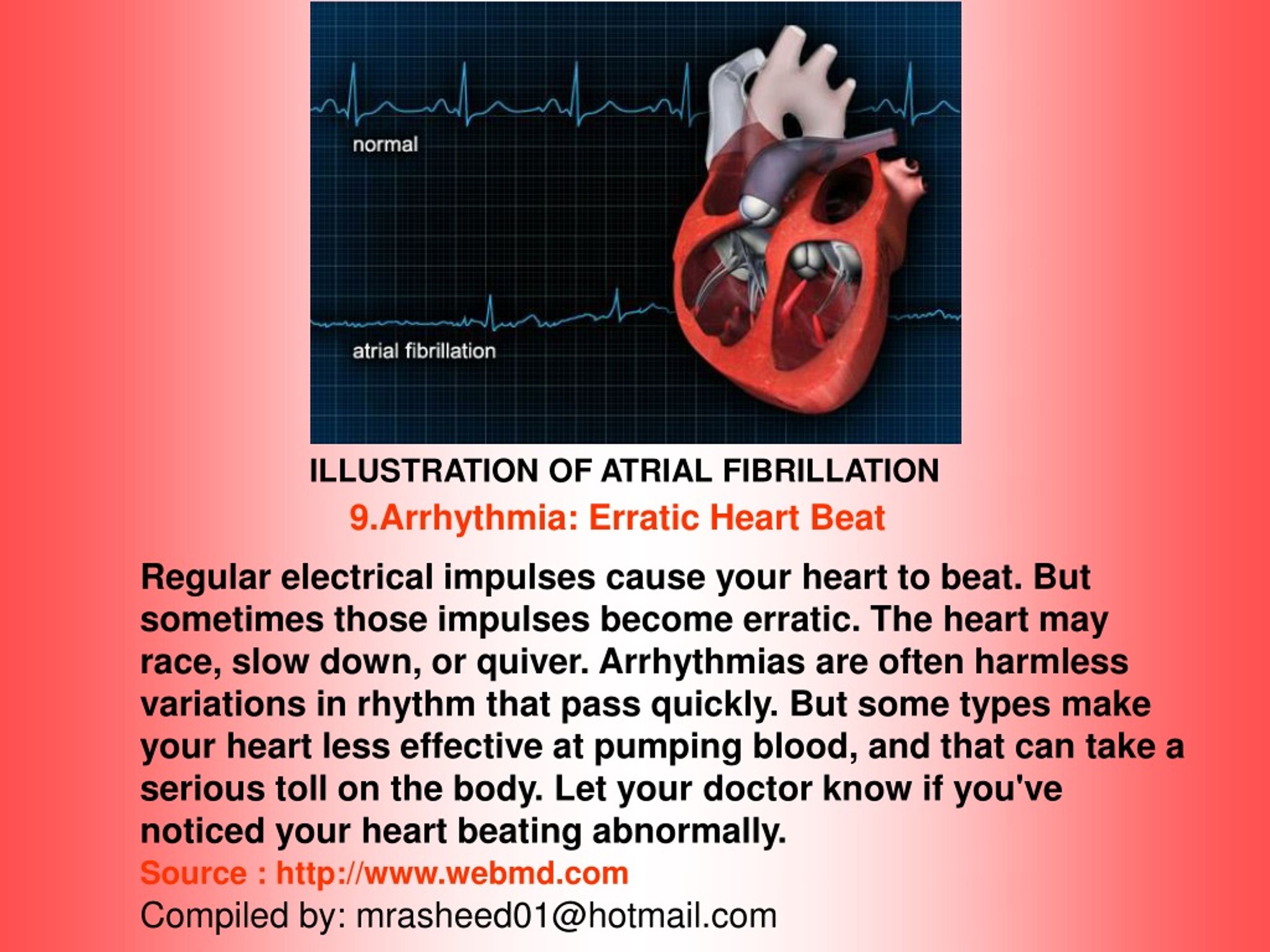 Heart attack перевод. Heart Fibrillation. Causes of Atrial Fibrillation. Treatment of Cardiac Fibrillation.