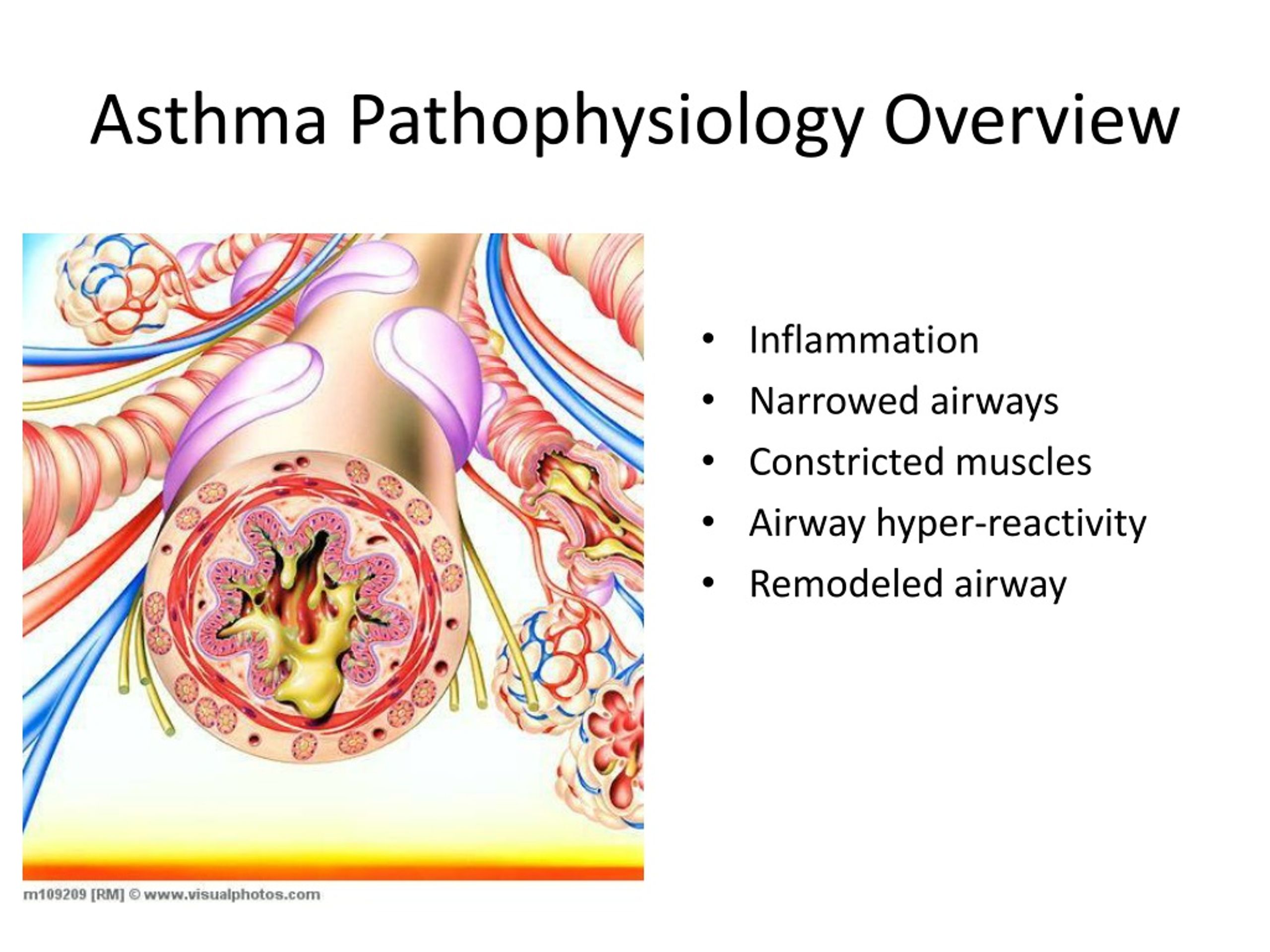 PPT - Pediatric Asthma PowerPoint Presentation, free download - ID:349643