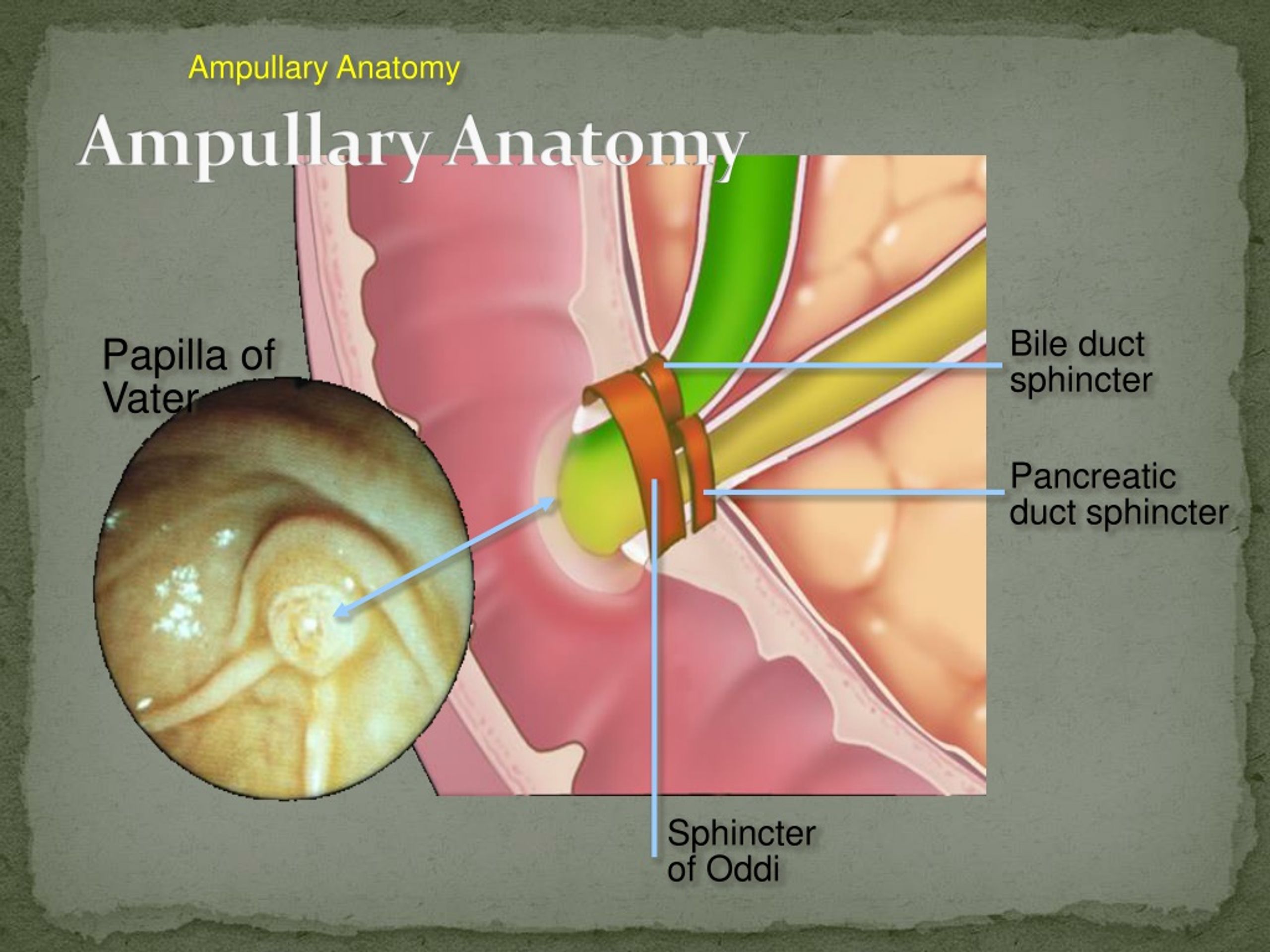Как выглядит сфинктер. Анатомия сфинктера Одди. Сфинктер Одди расположение. Анатомические элементы сфинктера Одди.