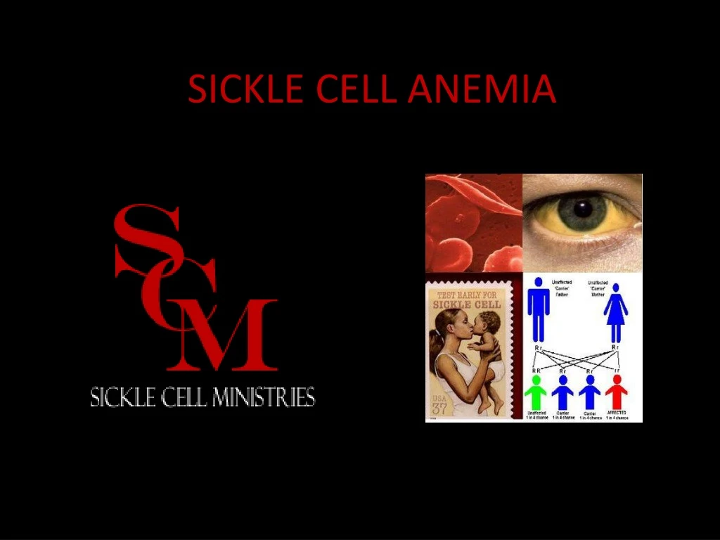 Ppt Sickle Cell Anemia Powerpoint Presentation Free Download Id393020 4599